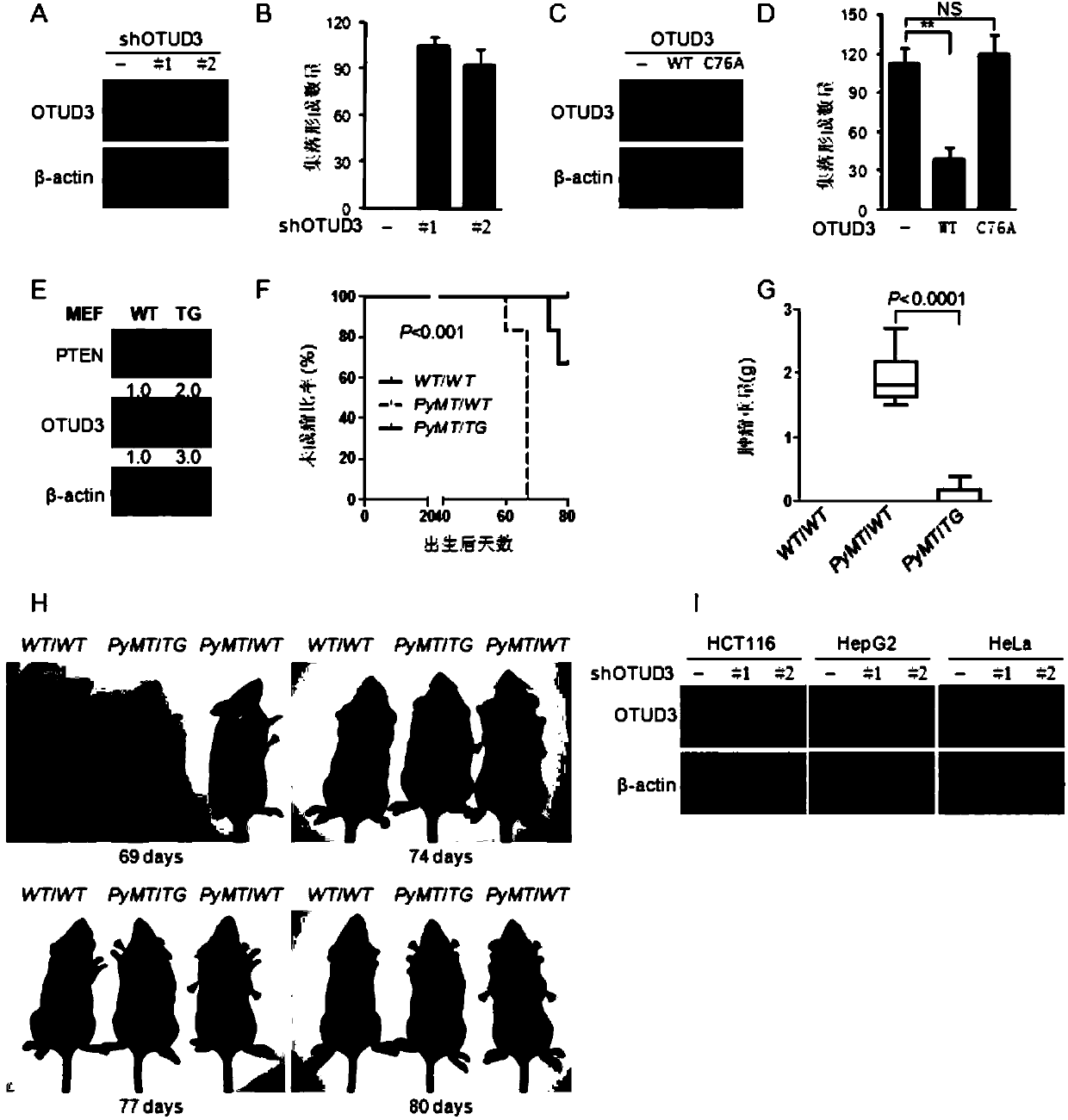 OTUD3-E86K protein as well as coding gene and application thereof