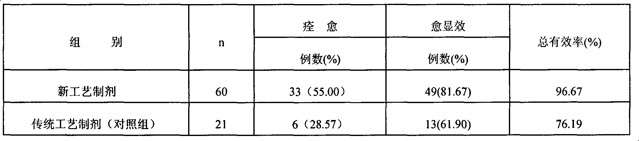 Method for preparing Chinese medicinal granules for treating cold