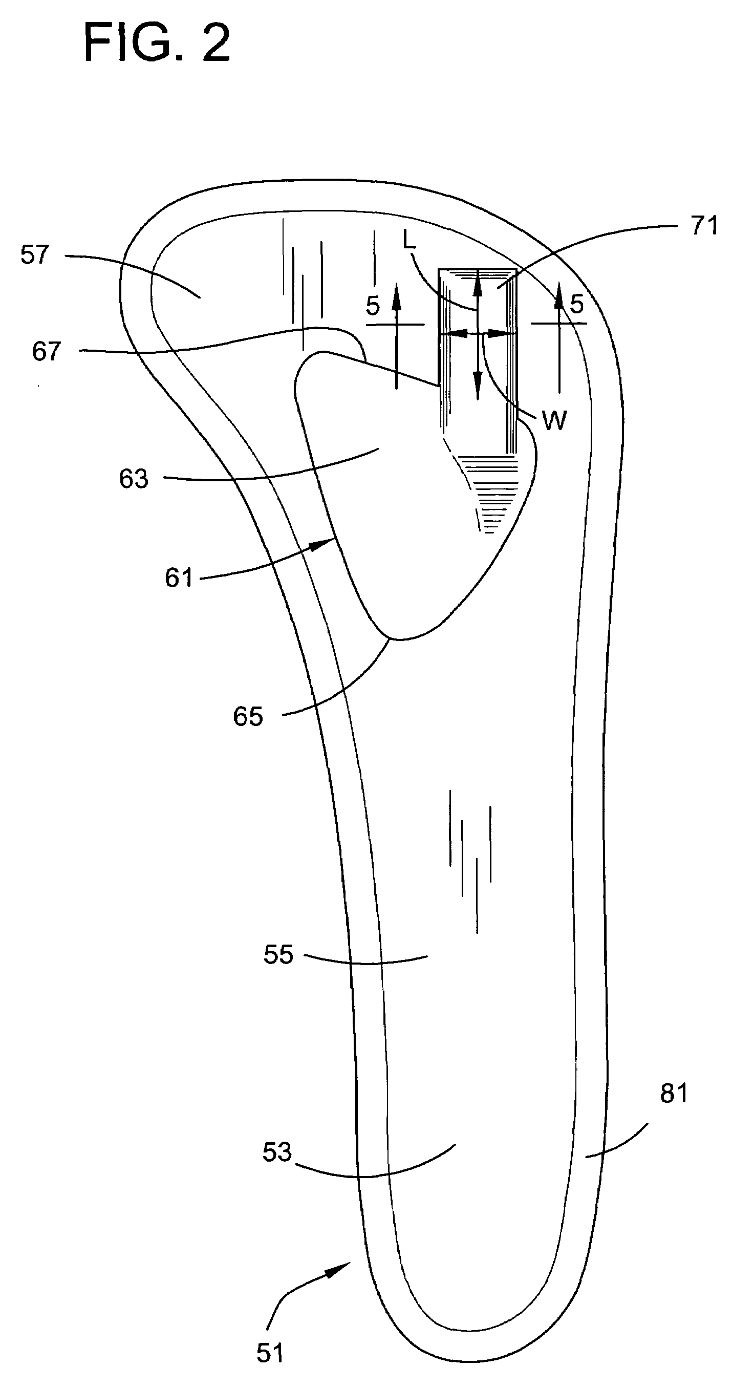 Insole with a neuroma pad