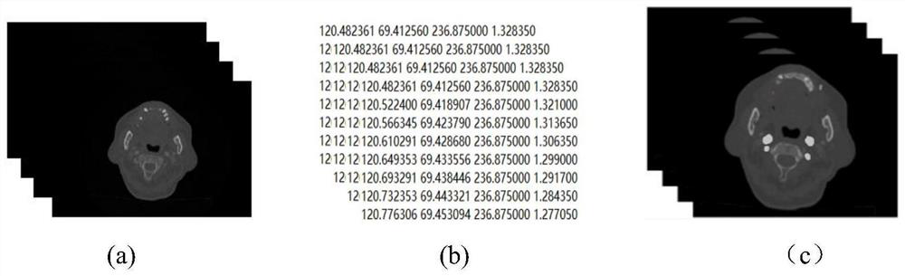 Carotid artery extraction method based on convolutional neural network