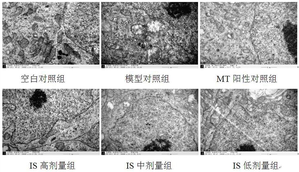 Application of Isoxaxifrage in the Preparation of Protective Drugs for Rat Pineal Gland Damage