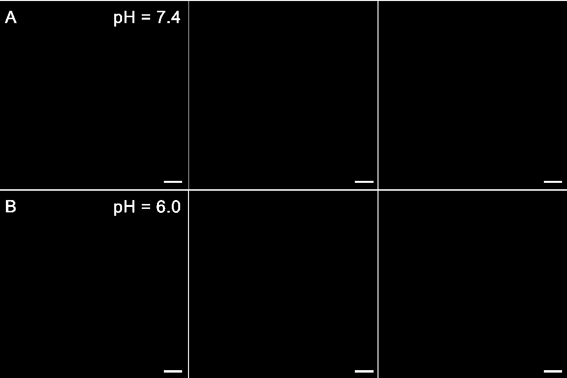 Cell membrane imaging fluorescence probe and application thereof