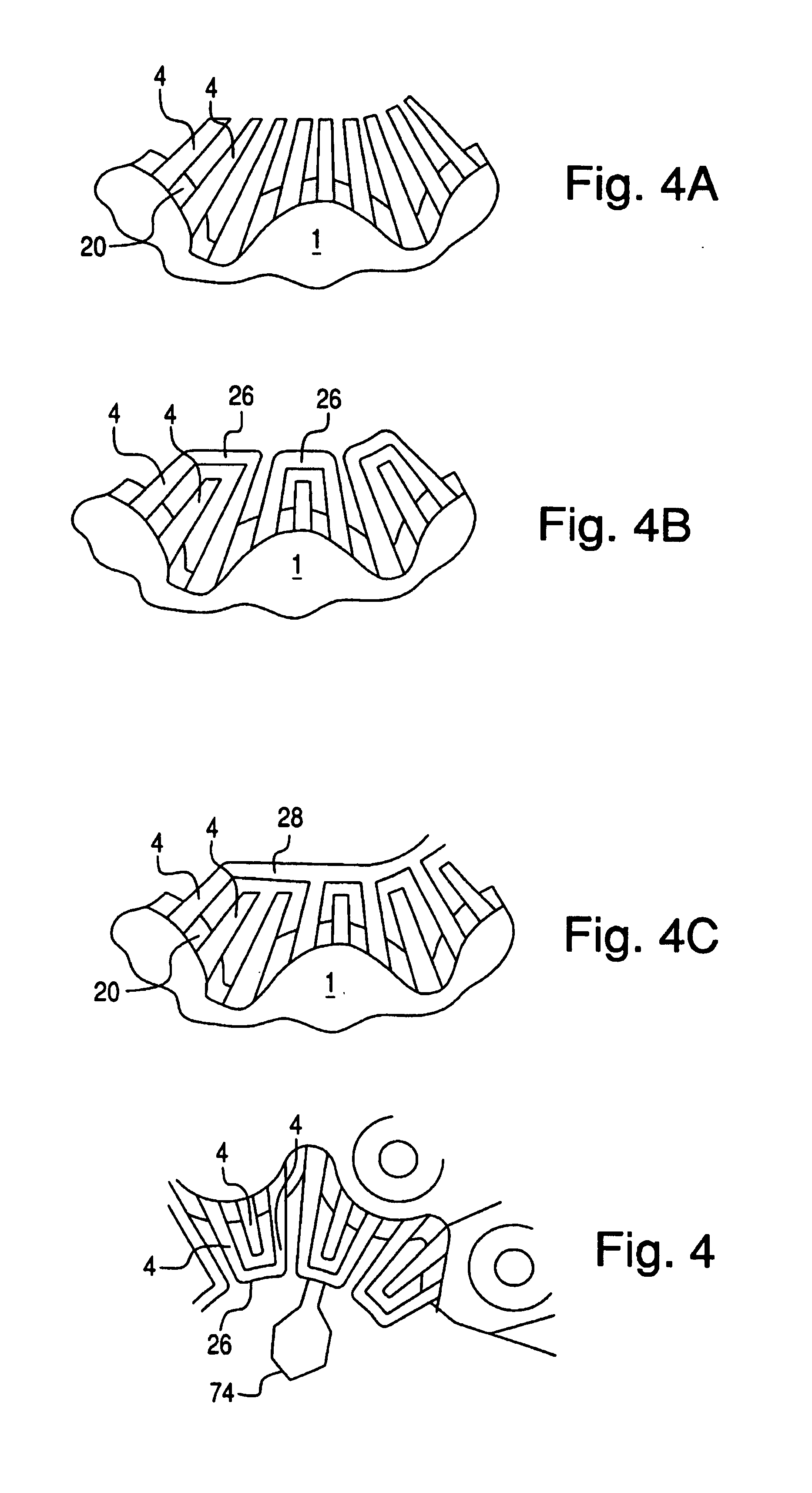 Current rectifier assembly for rotating electrical machines, in particular motor vehicle alternator