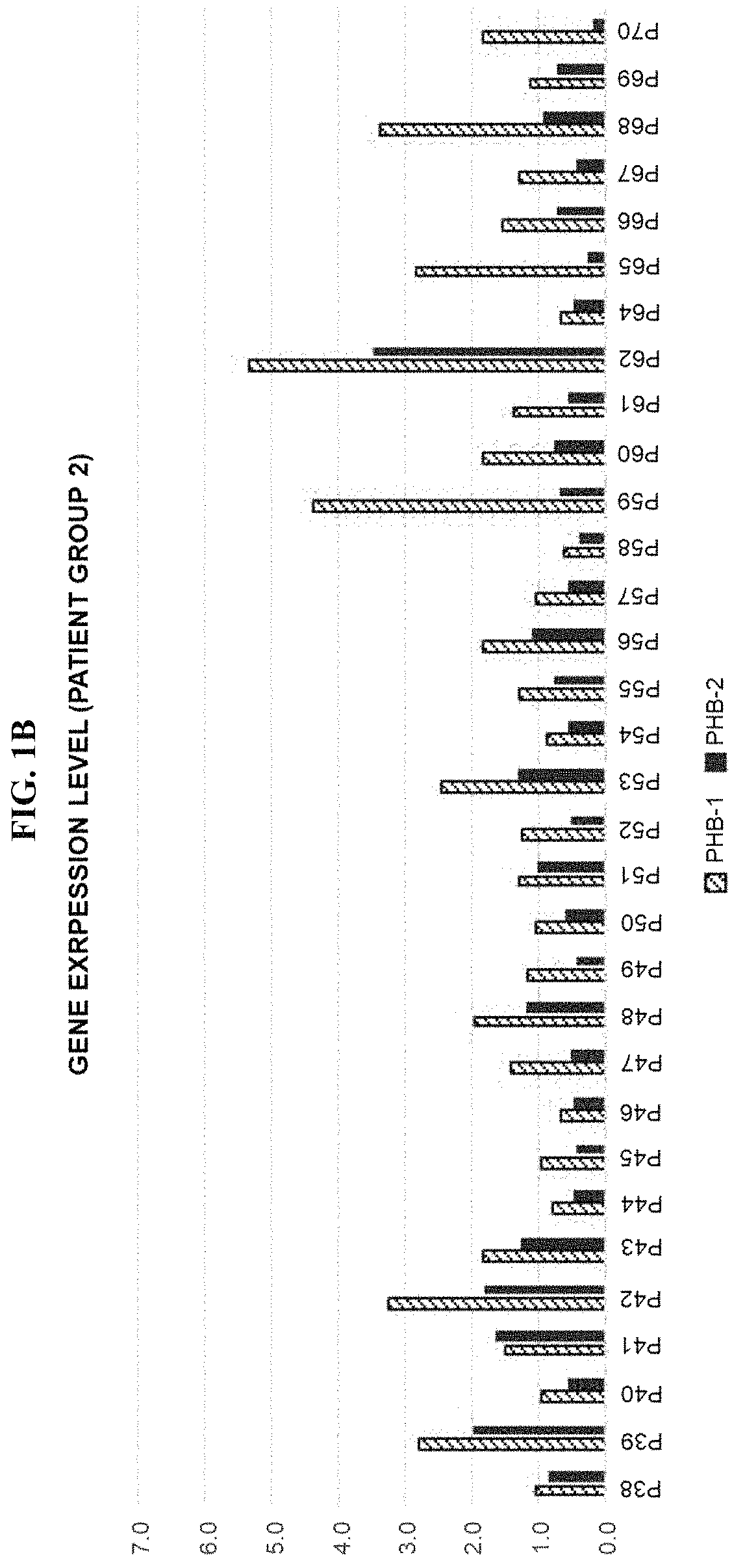 Leukemia diagnostic kit targeting prohibitin gene and diagnostic method using same