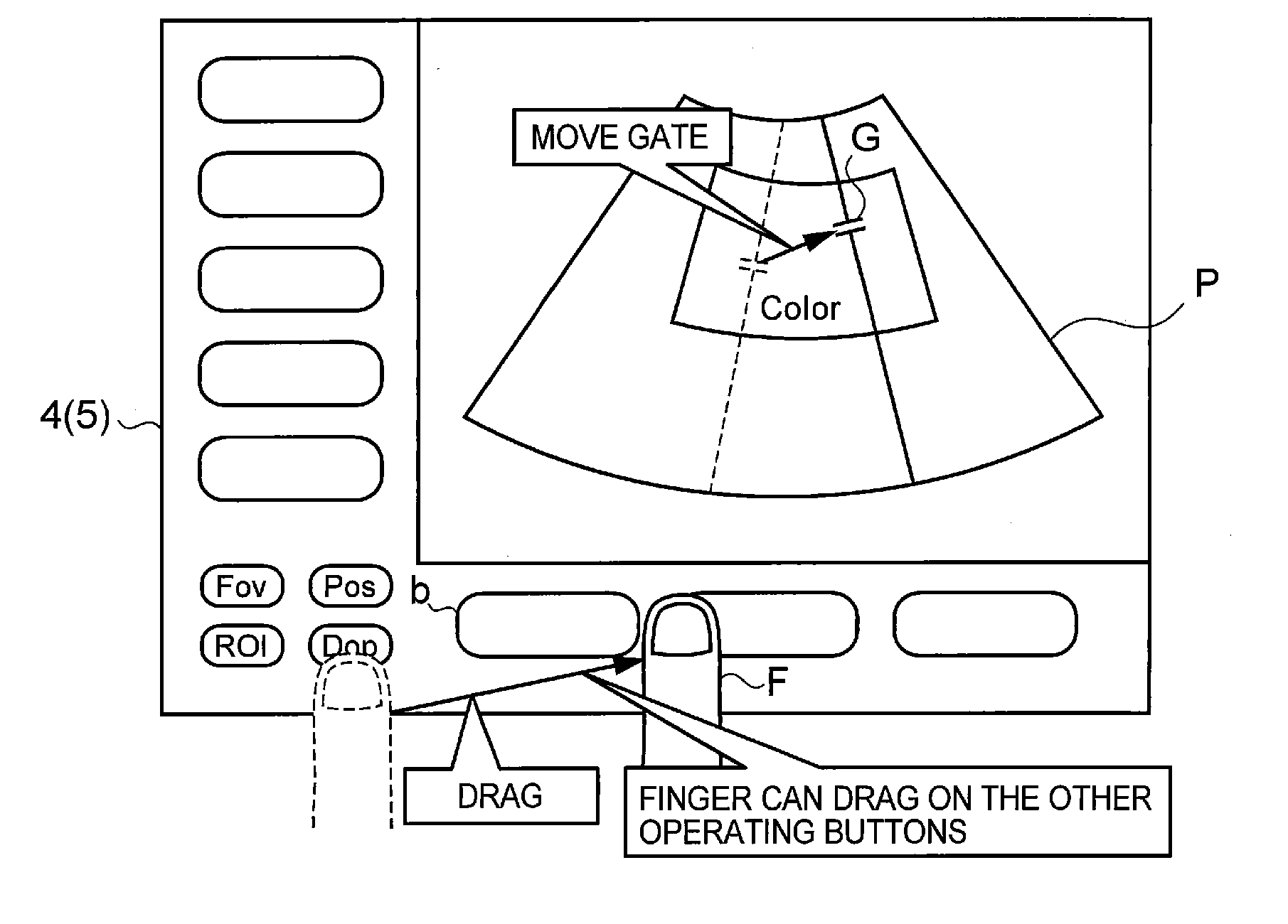 Ultrasonograph