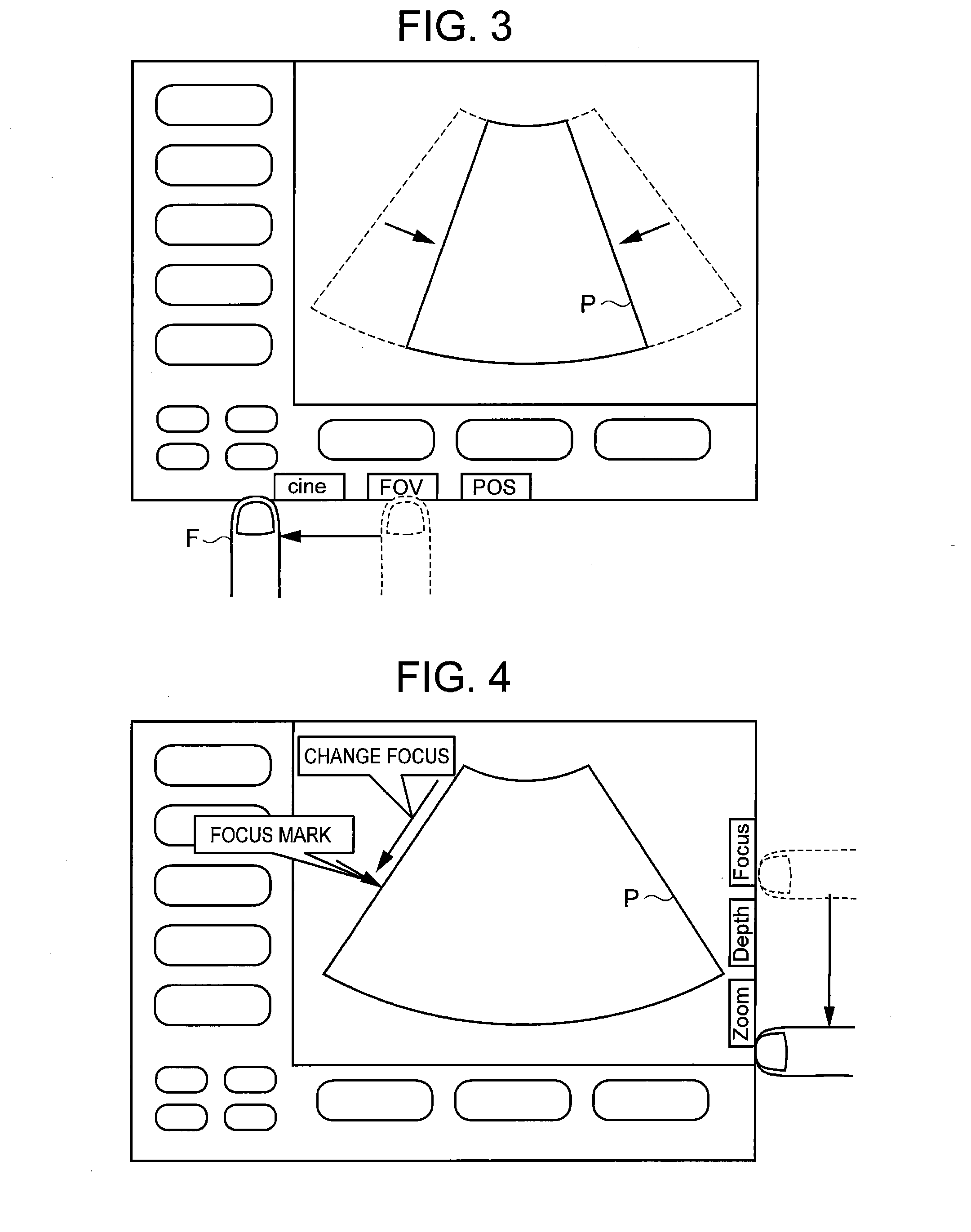 Ultrasonograph