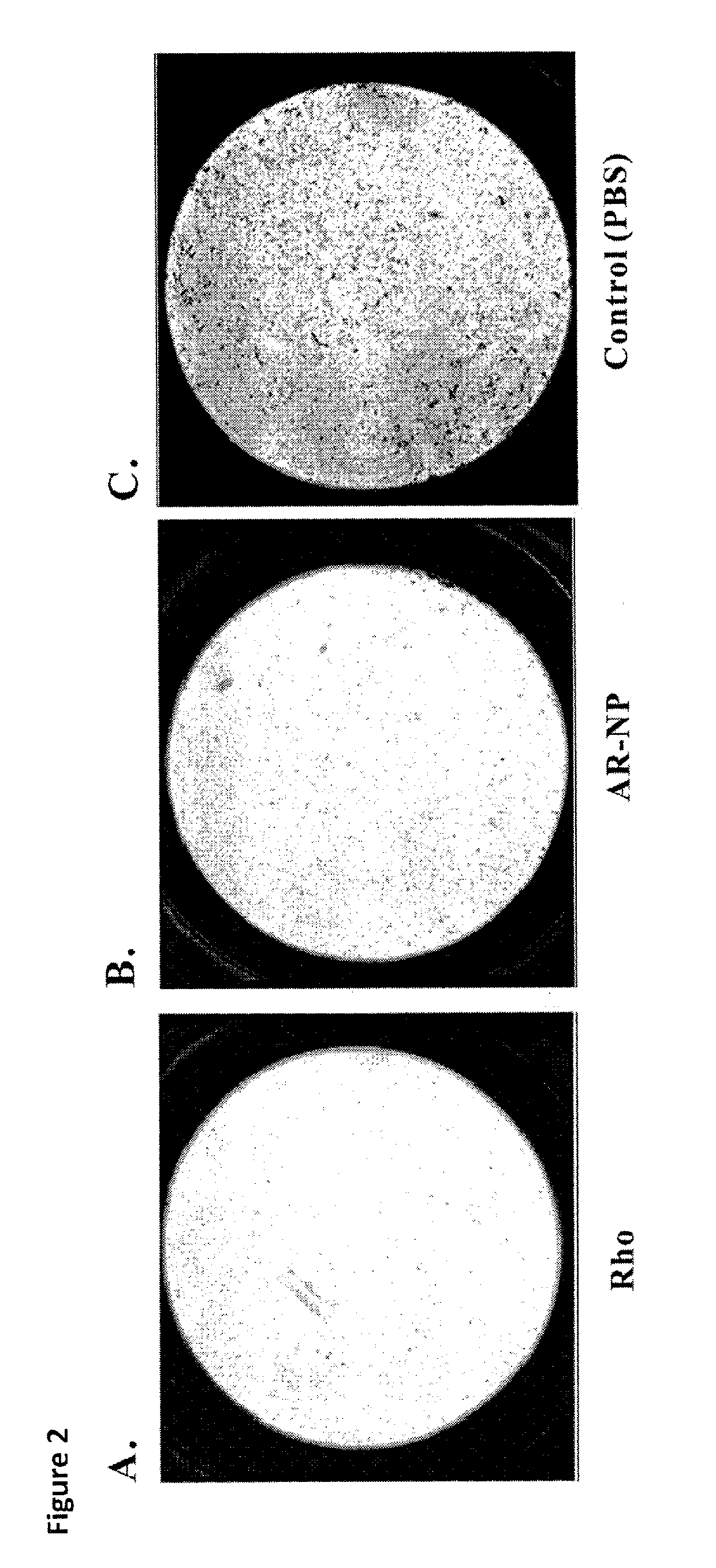 Disintegrin variants and pharmaceutical uses thereof