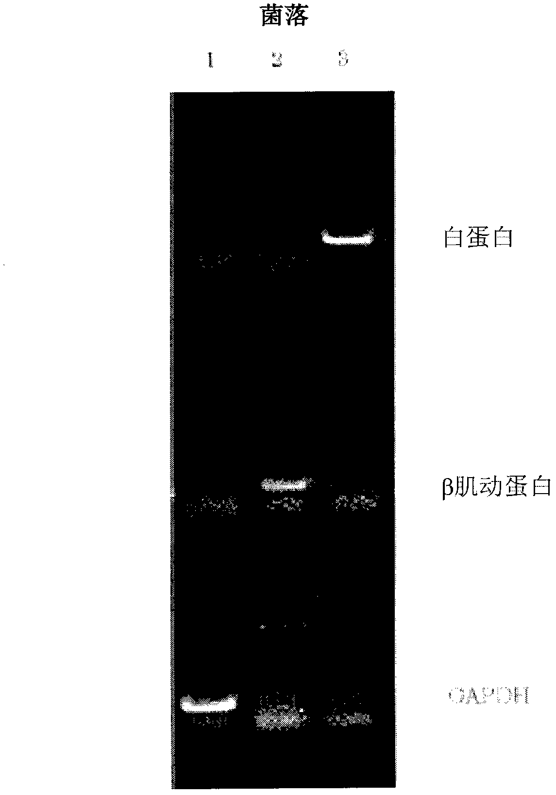 Method for synthesis of double-stranded DNA corresponding to RNA, and method for amplification of the DNA