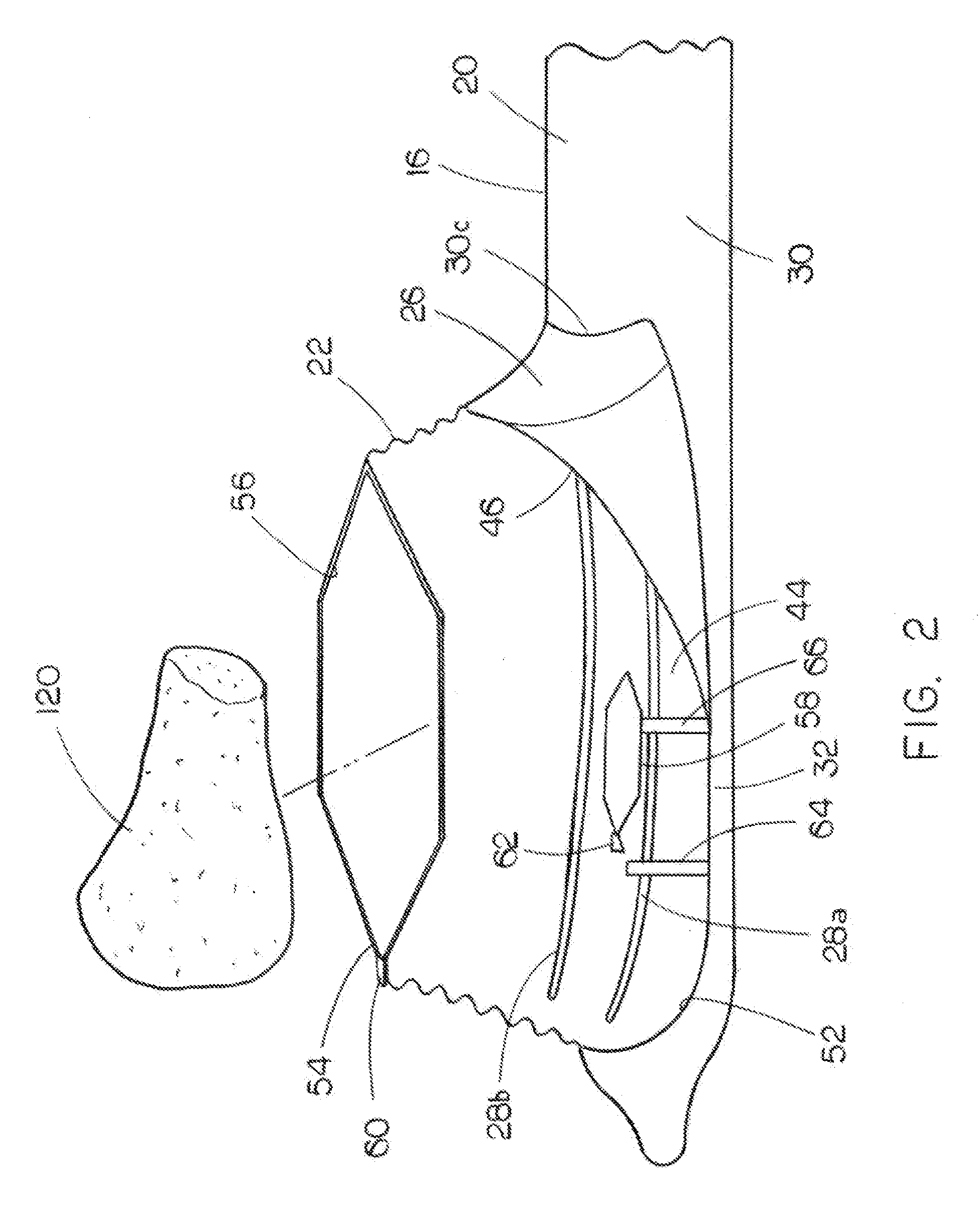 Morcellator shield with deployable bag