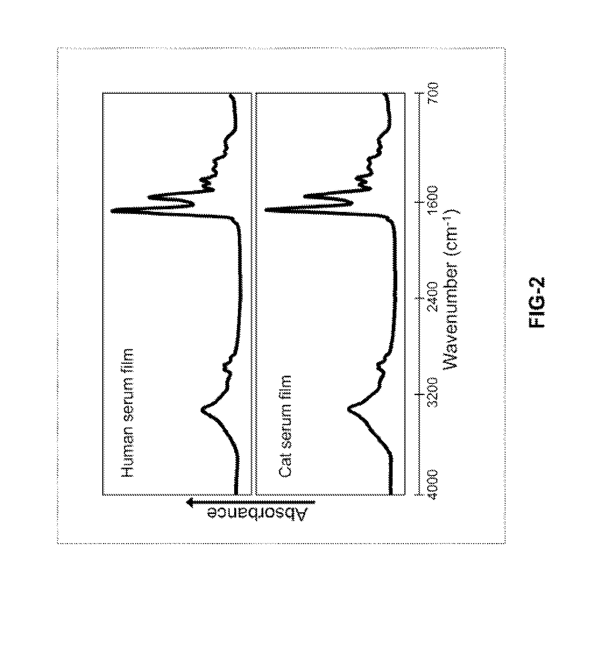 Rapid diagnosis of a disease condition using infrared spectroscopy