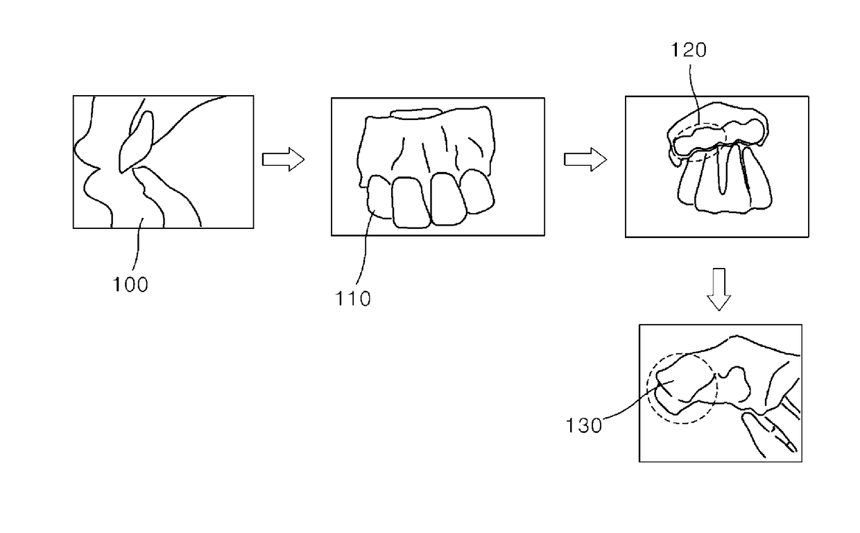 Method of manufacturing scaffold for treatment of tooth extraction socket