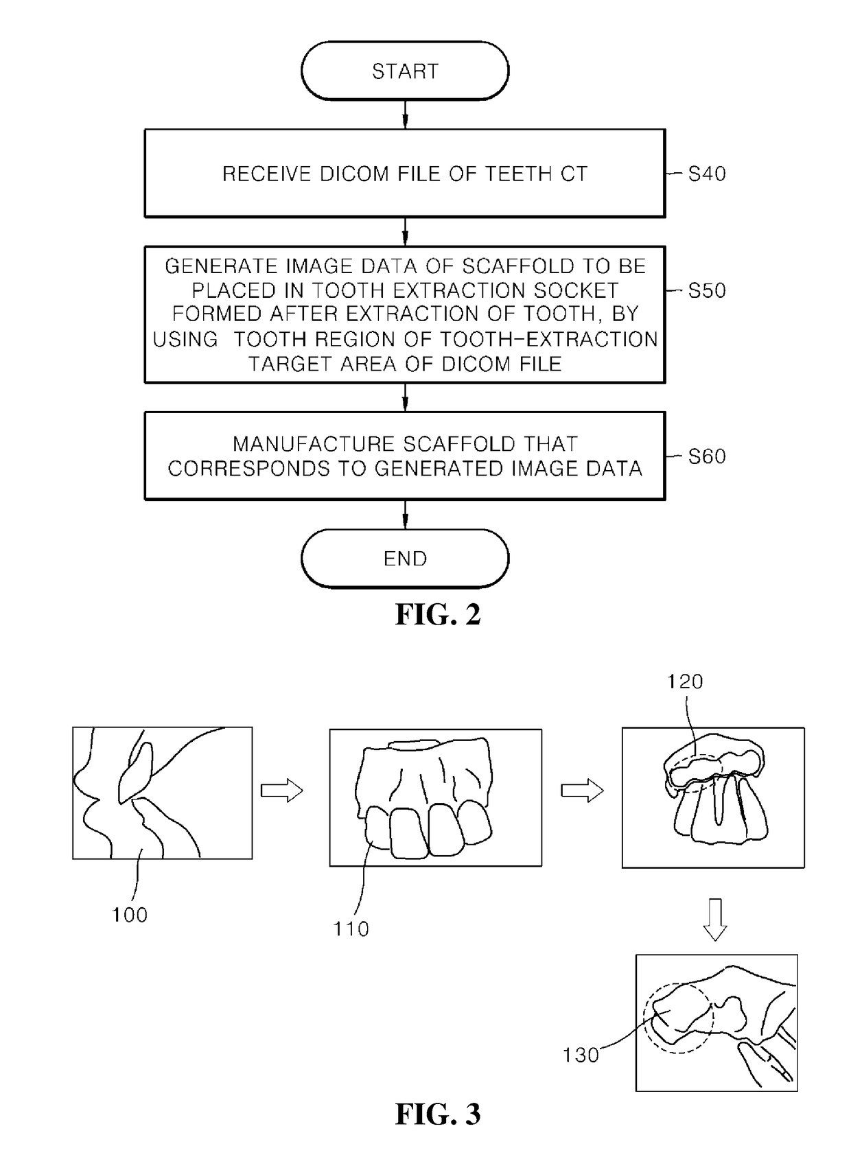 Method of manufacturing scaffold for treatment of tooth extraction socket