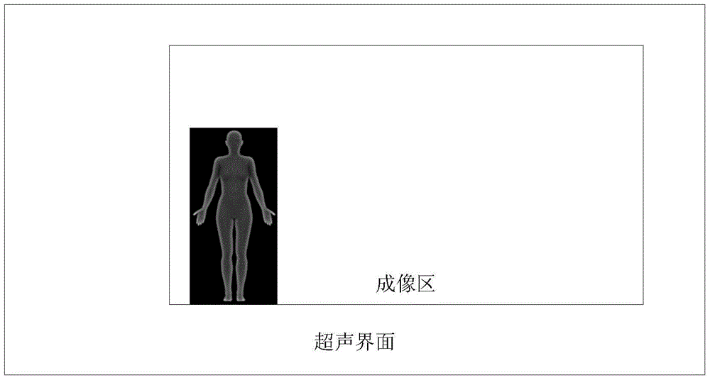 Body position icon, adding method, control device and ultrasonic equipment of control device