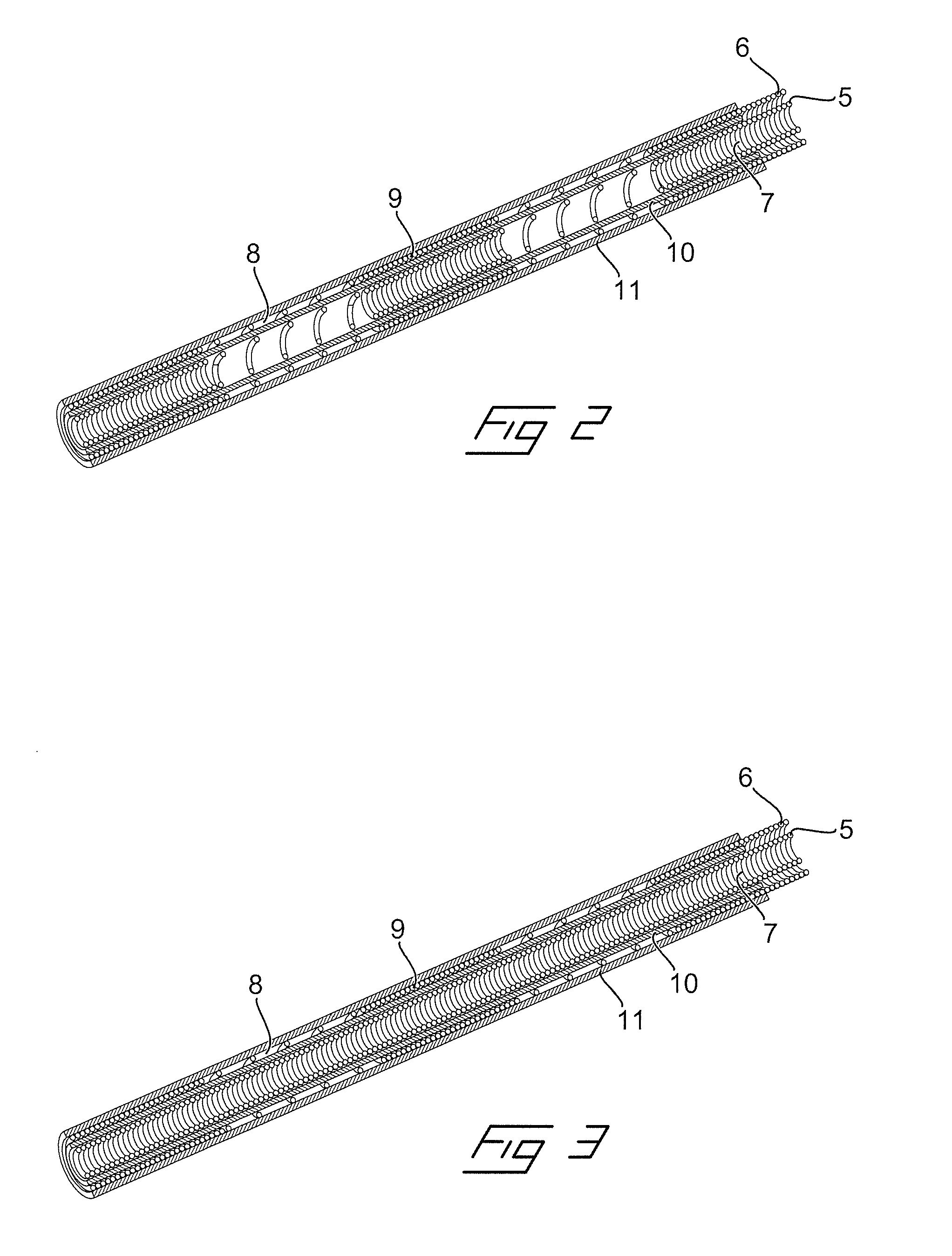 Medical lead assembly and method for implantation thereof