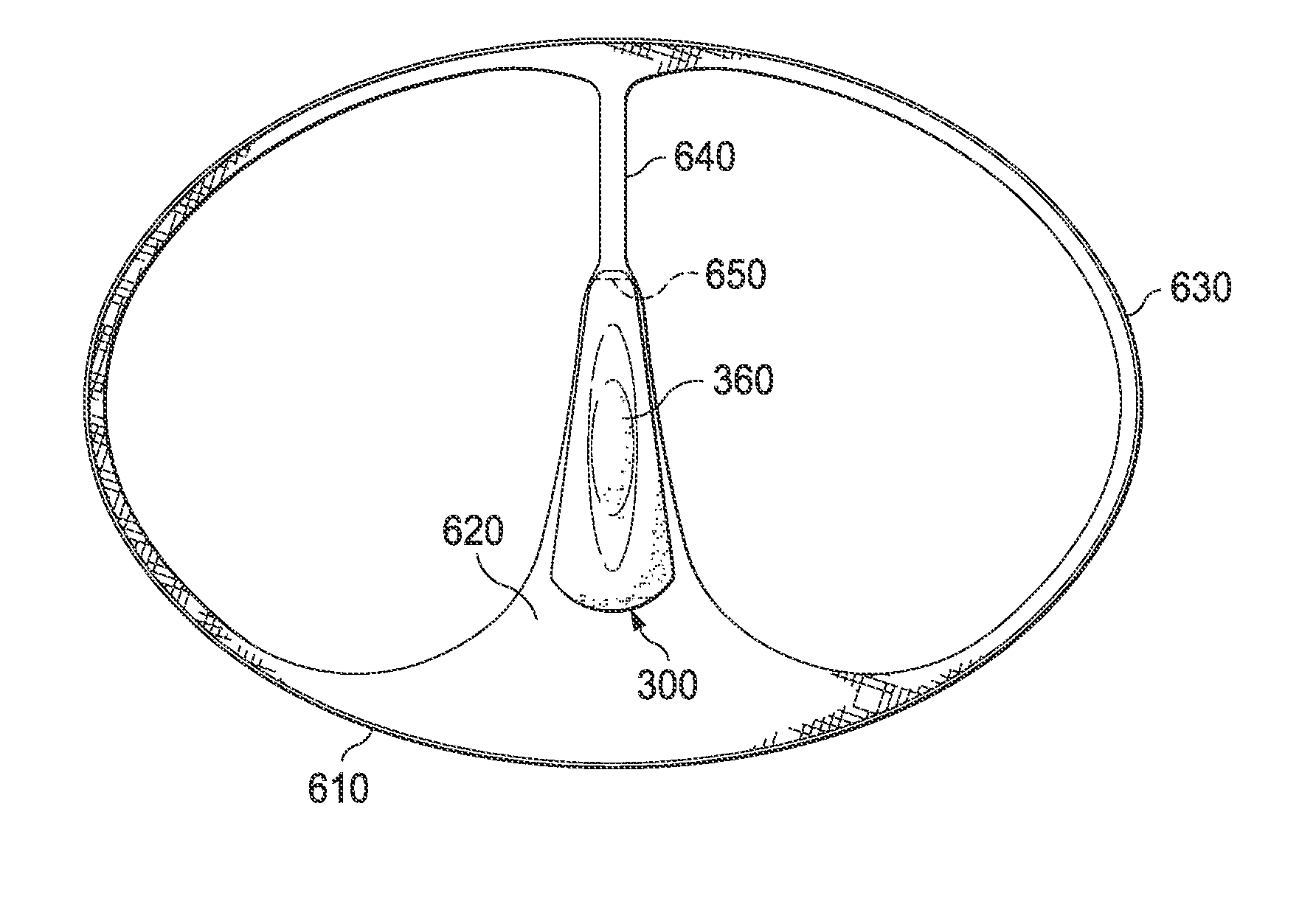 Three dimensional structural support for female pelvic organs in thong underwear