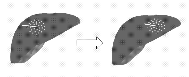 Soft tissue deformation simulation method based on coupling of mesh-free Galerkin and mass spring