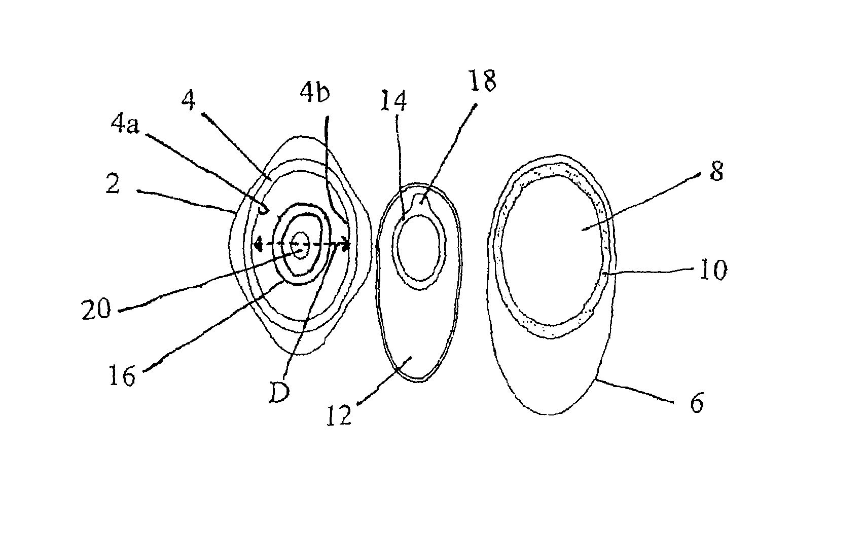 Ostomy bag