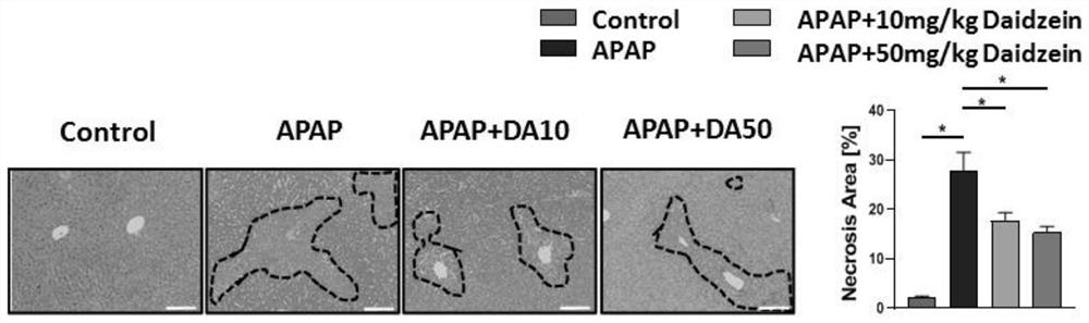 Application of daidzein in prevention and treatment of acetaminophen-induced acute liver injury