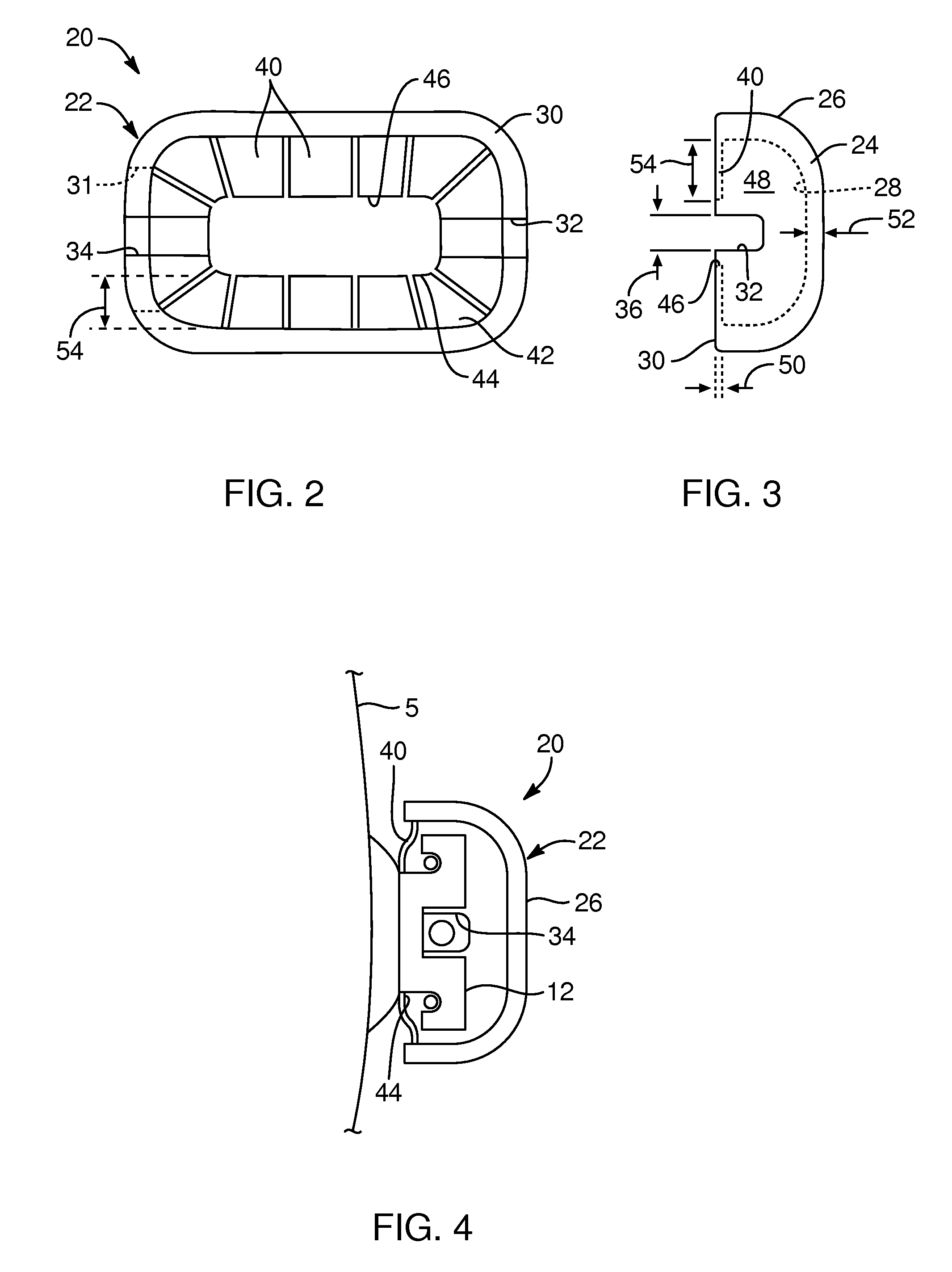 Devices, systems, and methods for orthodontic hardware