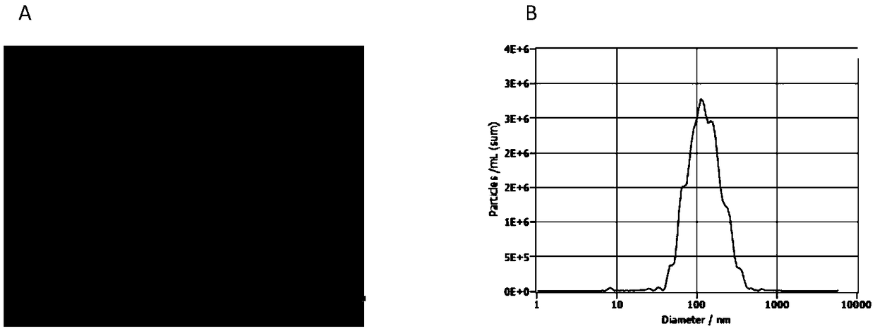 Chronic glomerular disease glomerulosclerosis marker and detection kit thereof