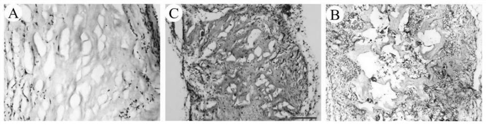 Preparation method and application of extracellular matrix scaffold with controllable pore structure