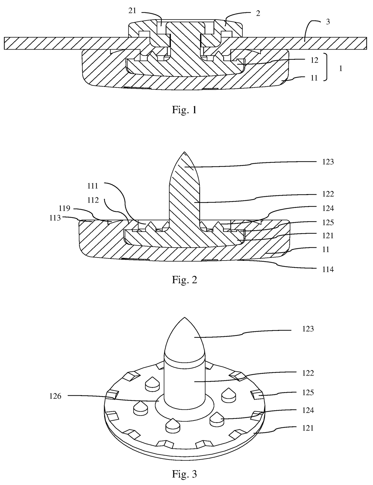 Snap fastener