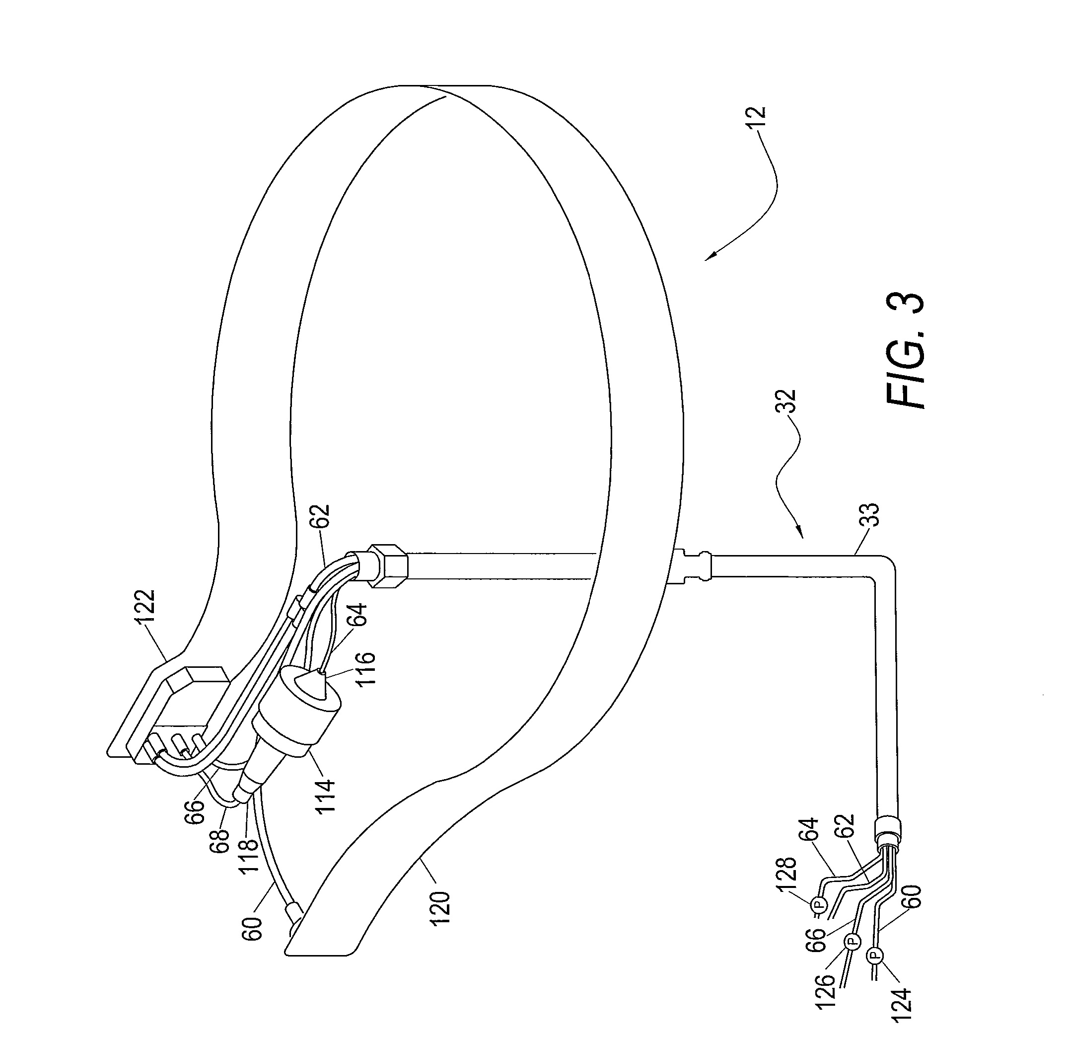 System for Blood Separation with a Separation Chamber Having an Internal Gravity Valve