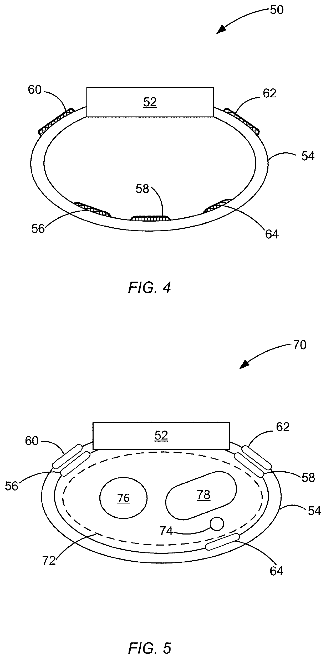 Blood pressure monitoring using a multi-function wrist-worn device