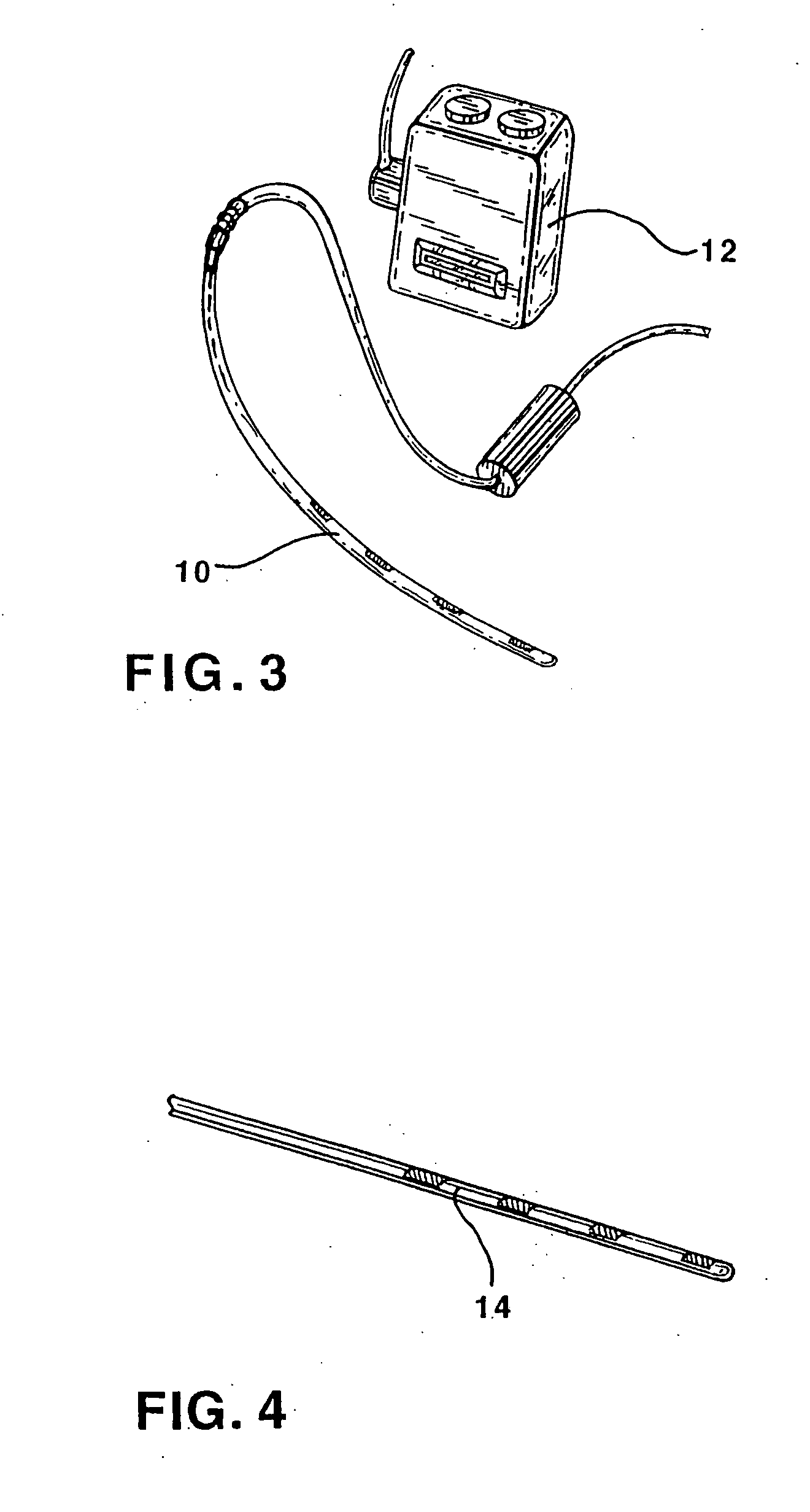 Peripheral nerve stimulation