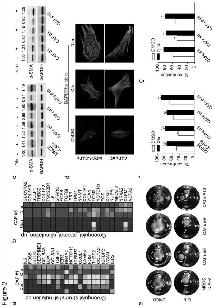 Markers of drug resistance of cancer cells, combination of preparations for reversing drug resistance of cancer cells and their applications