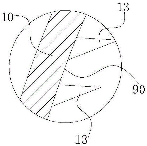 Surgical plate-type distracter