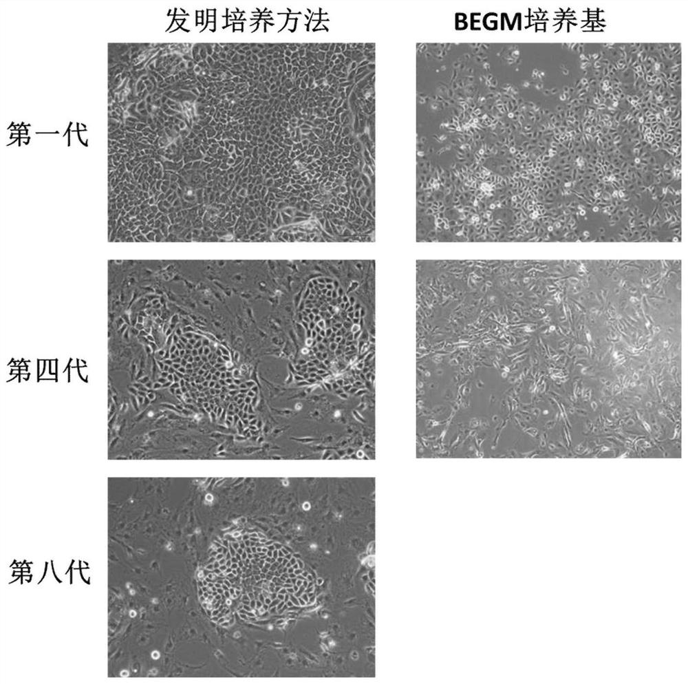 A kind of nasal epithelial stem cell culture method and nasal epithelial stem cell proliferation medium