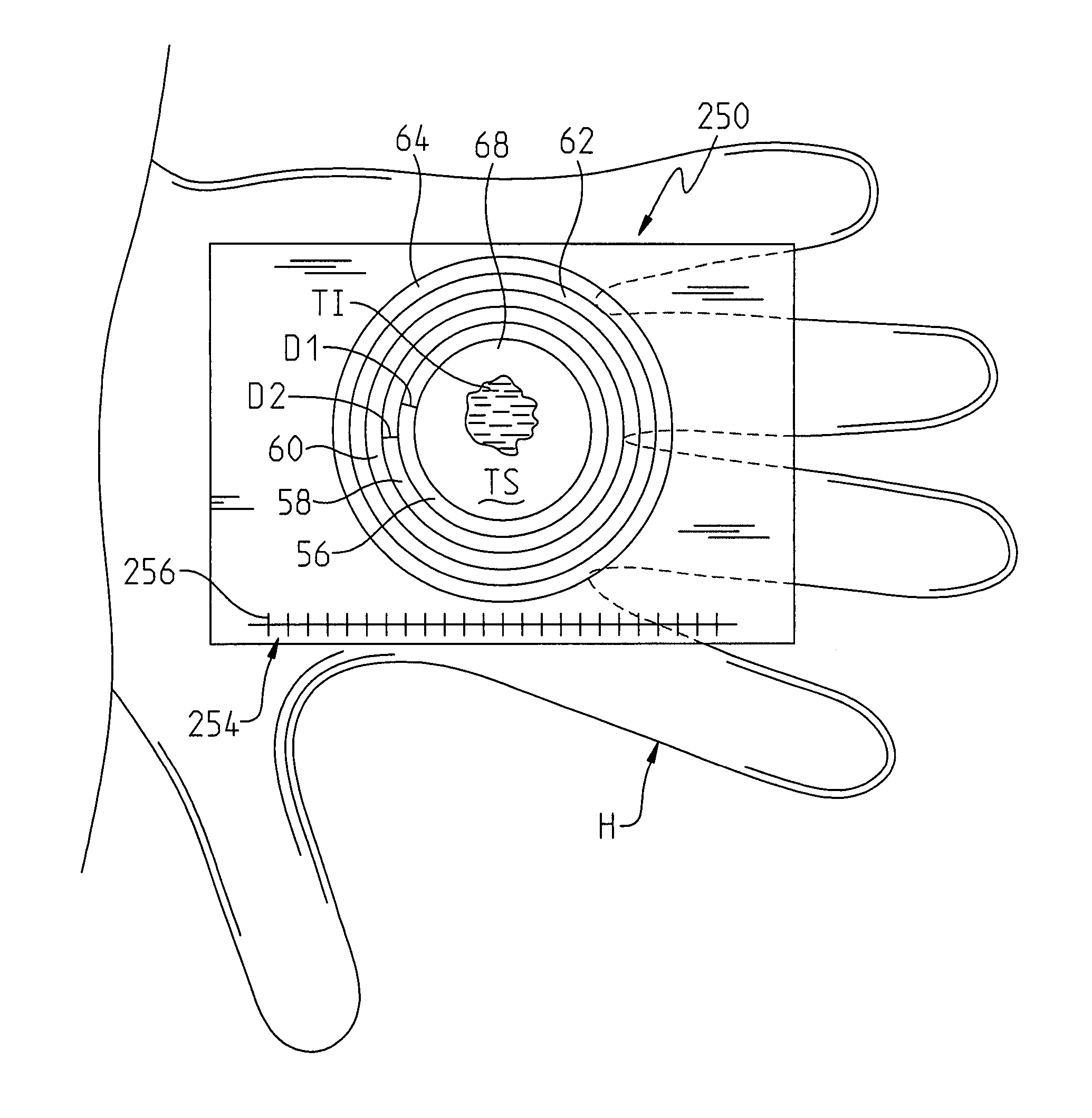 Method and apparatus for diagnosing conditions using tissue color