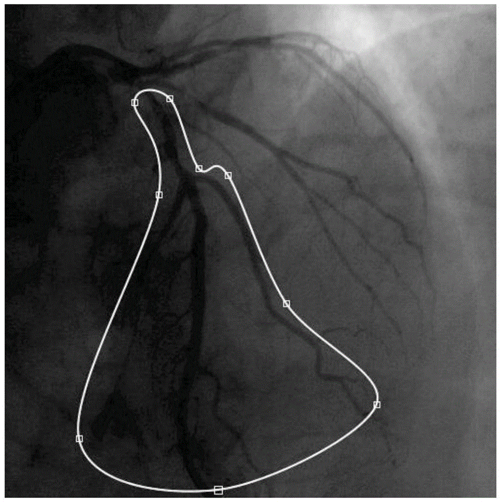 Computing method of blood flow volume and blood flow velocity of blood vessel per unit time