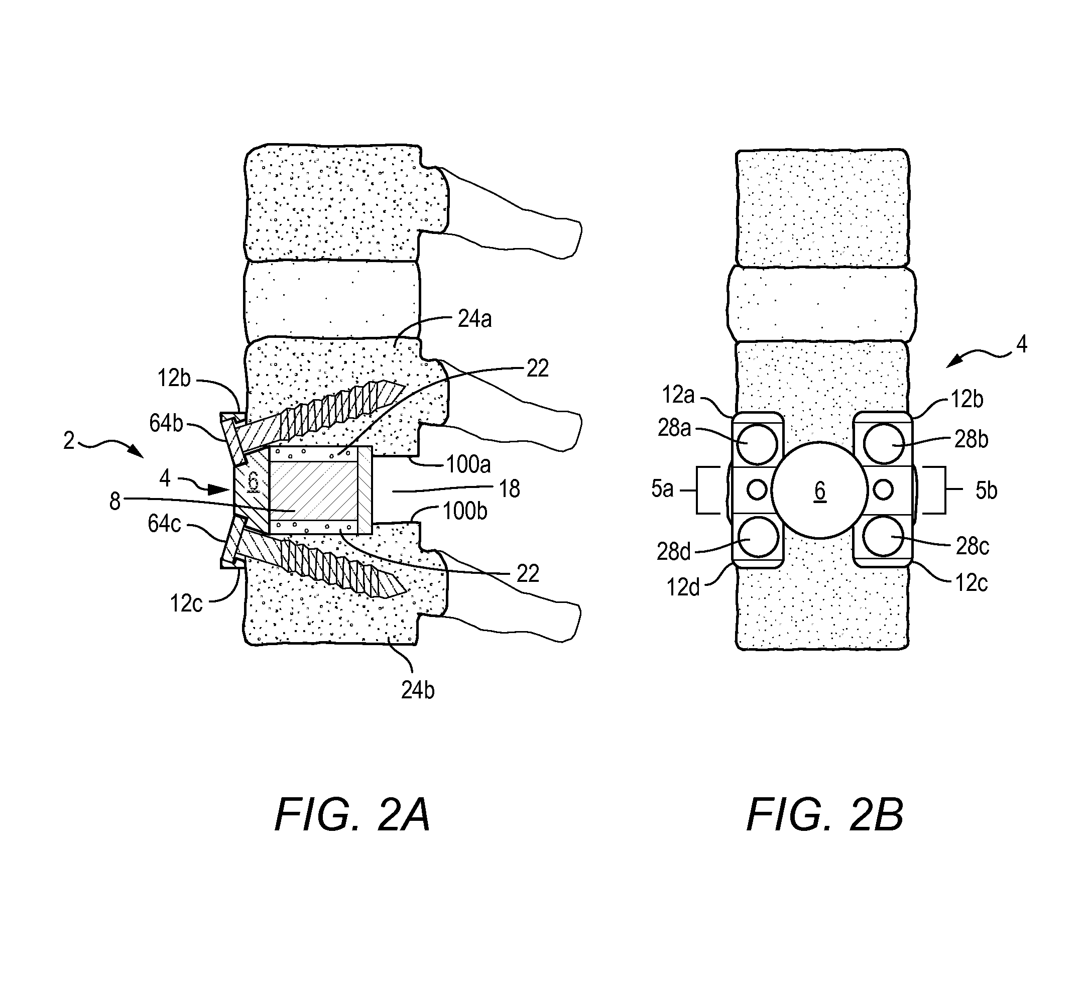 Anterior intervertebral spacer and integrated plate assembly and methods of use