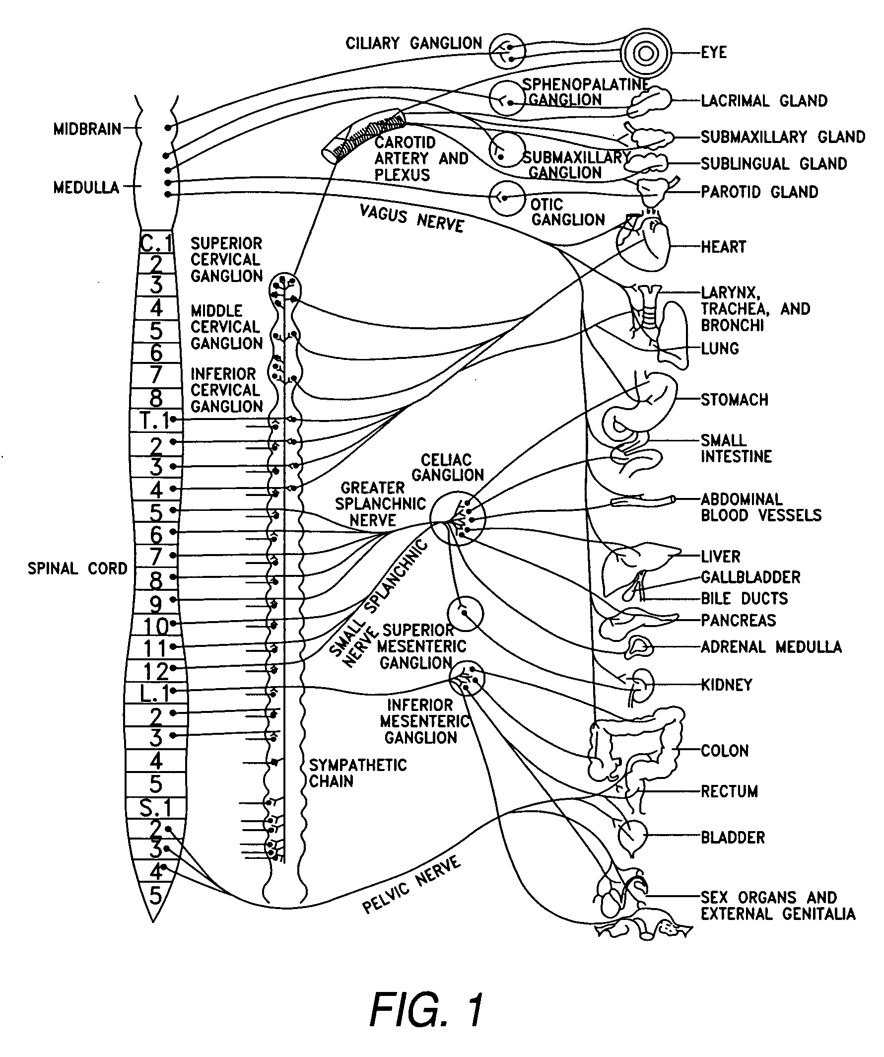 Nerve stimulation for treatment of obesity, metabolic syndrome, and type 2 diabetes