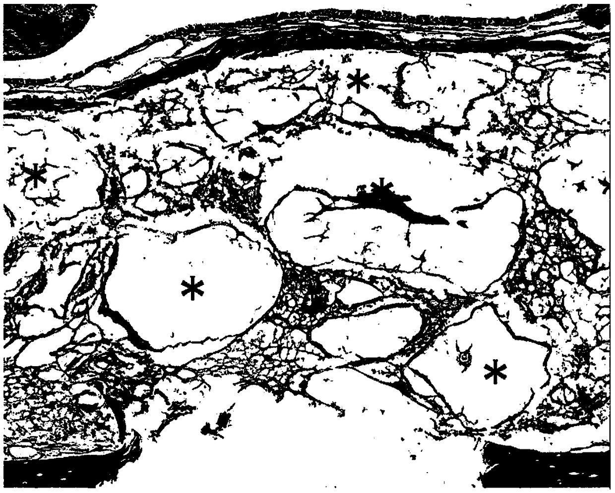 Construction method of mouse sinus elevation model based on BIO-OSS bone powder