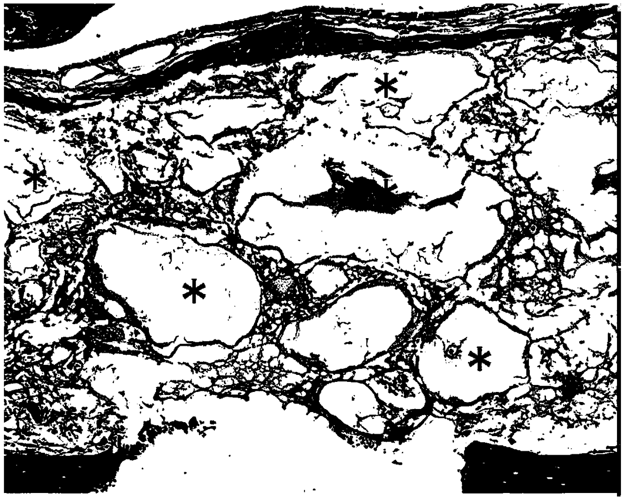 Construction method of mouse sinus elevation model based on BIO-OSS bone powder