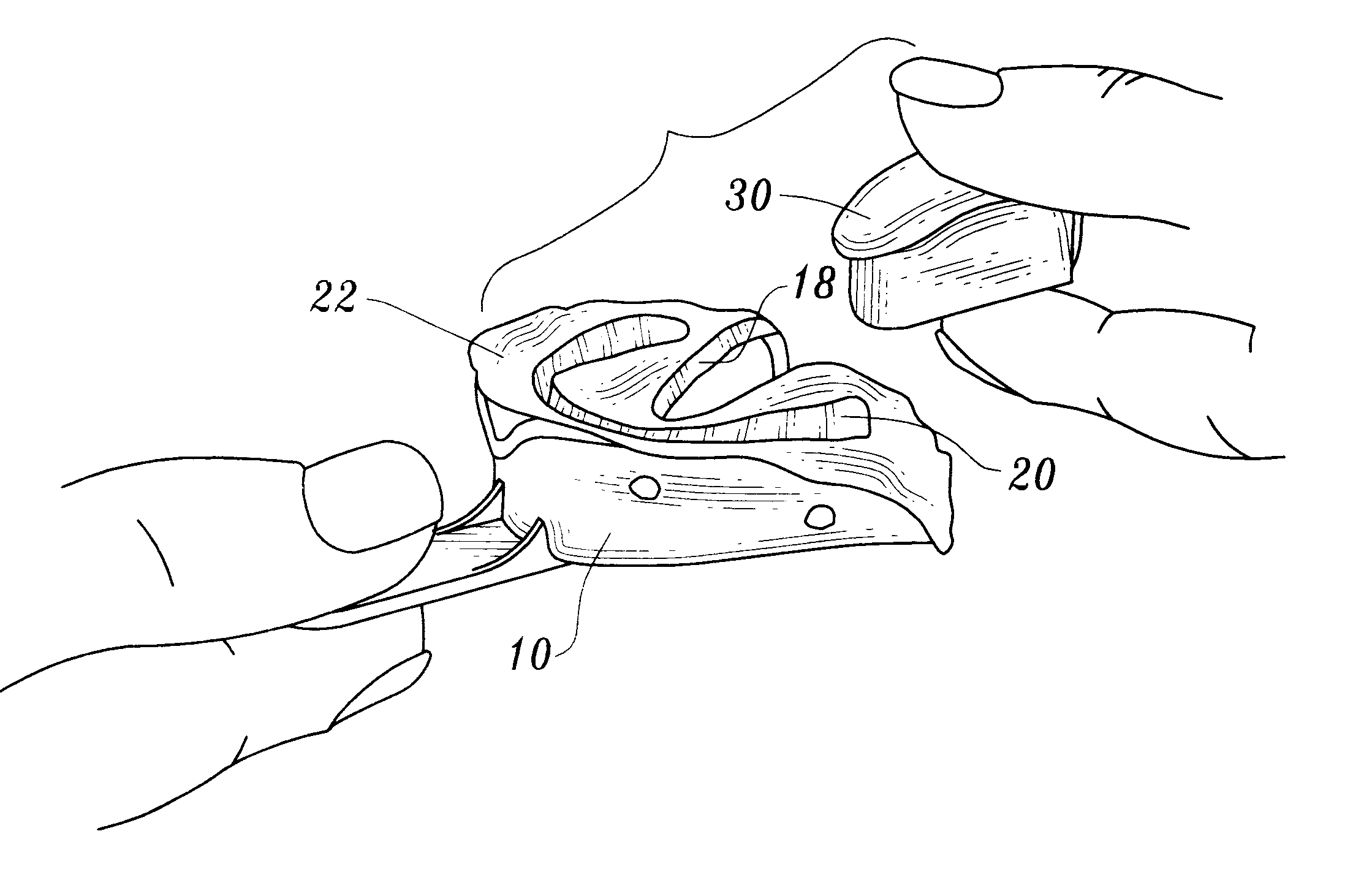 System for forming dental impressions