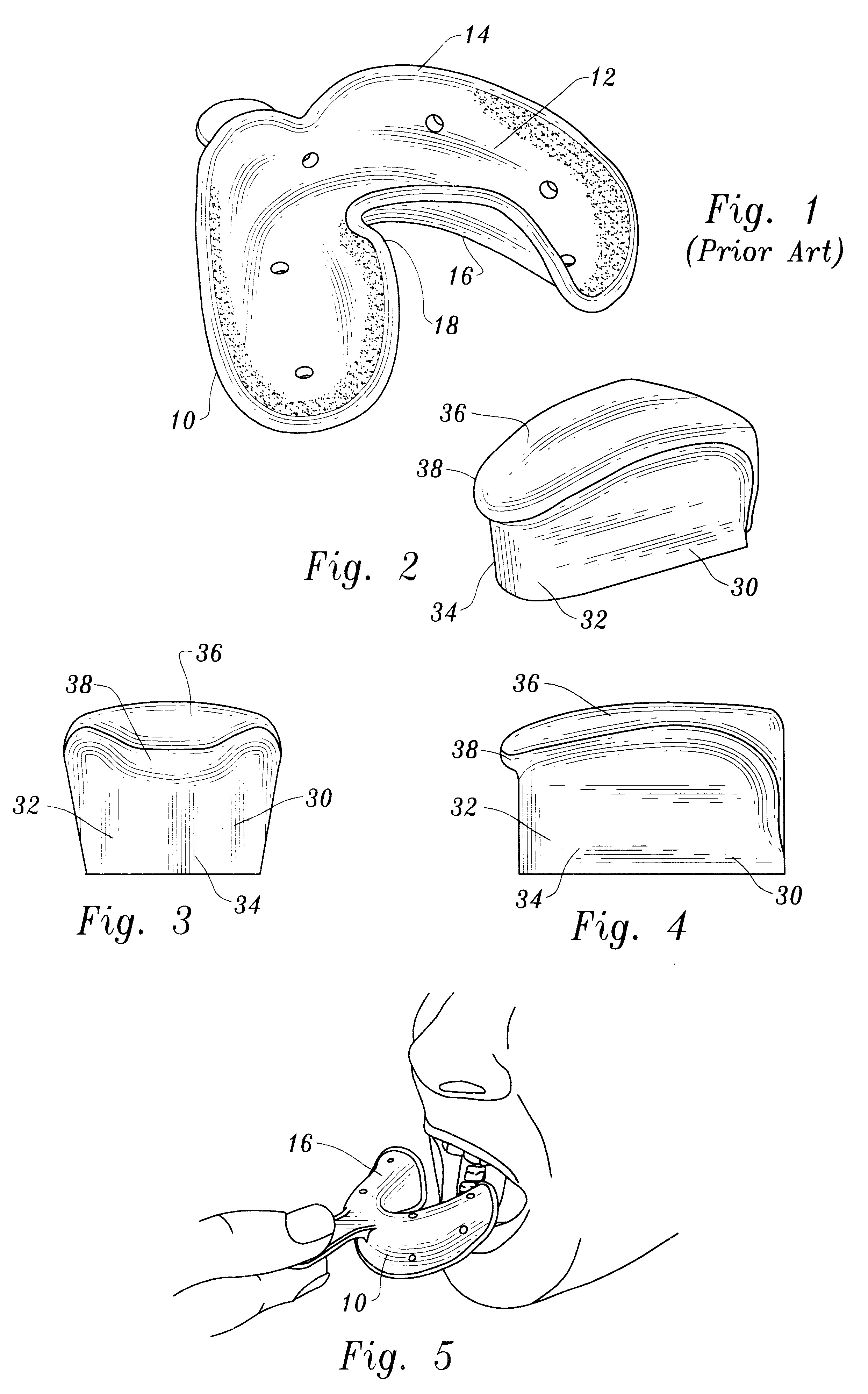 System for forming dental impressions