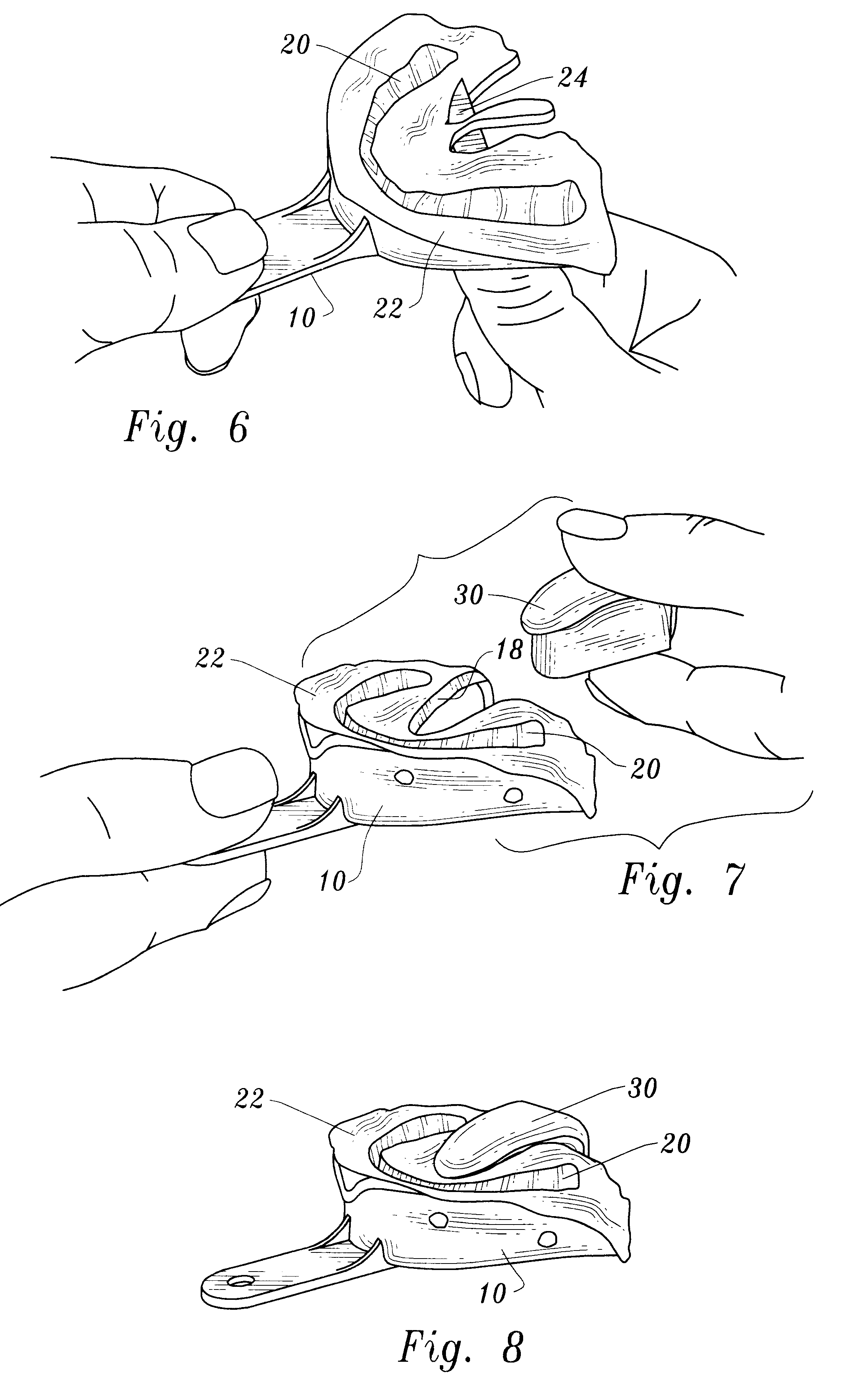 System for forming dental impressions