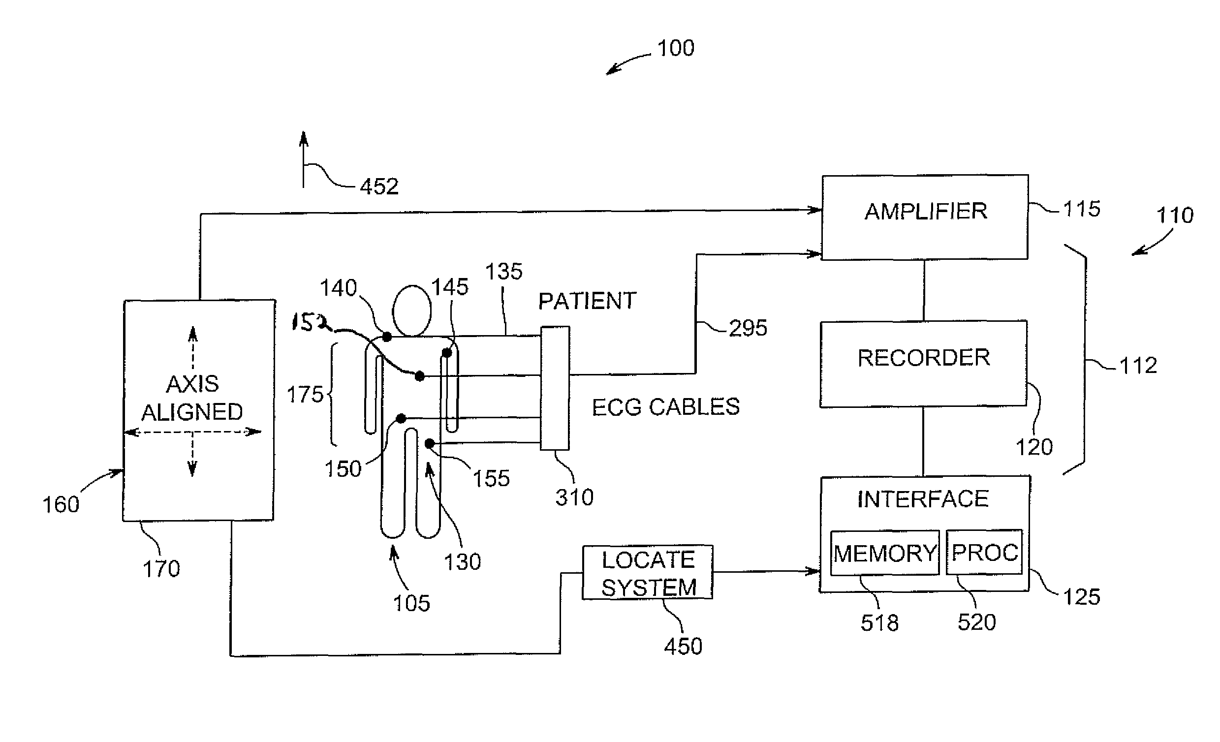 System and method of noise reduction in an electrocardiology study