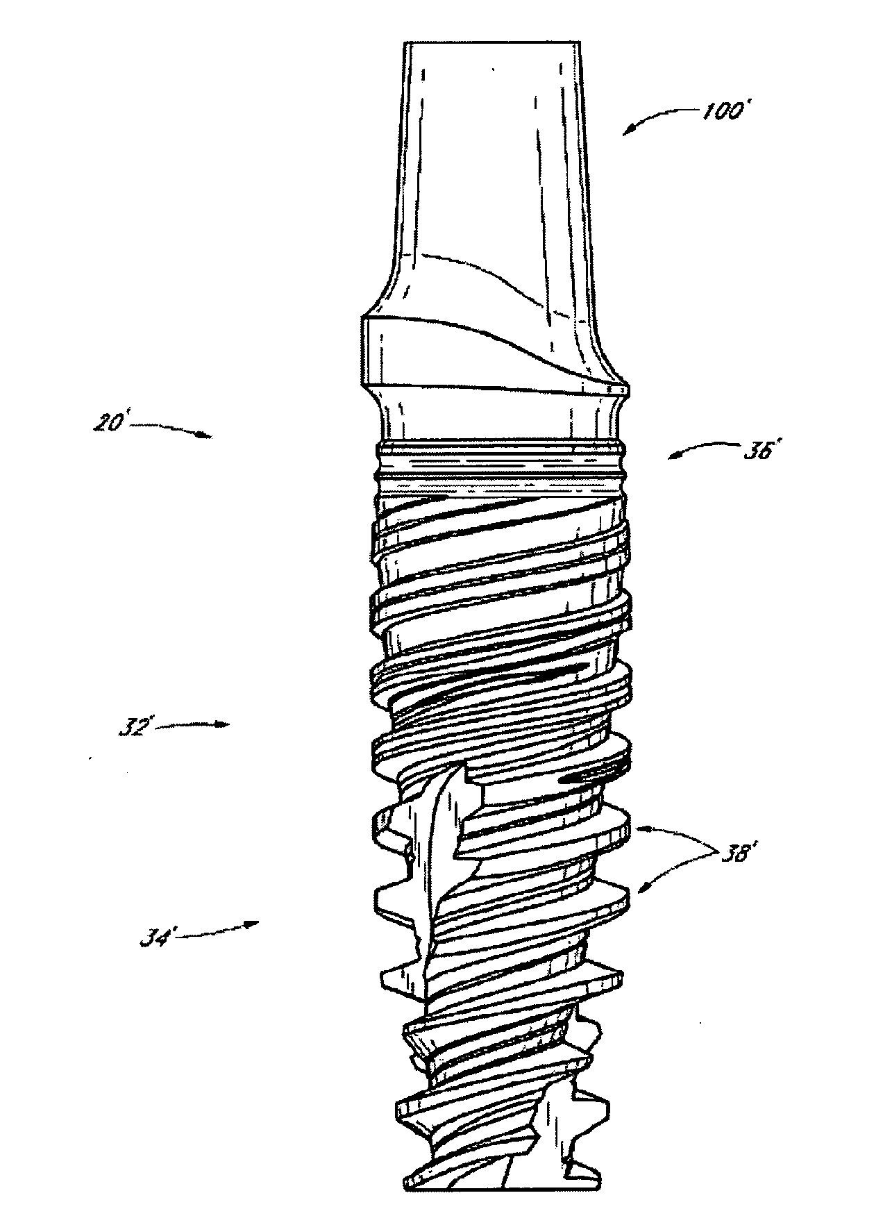 Bone implant application