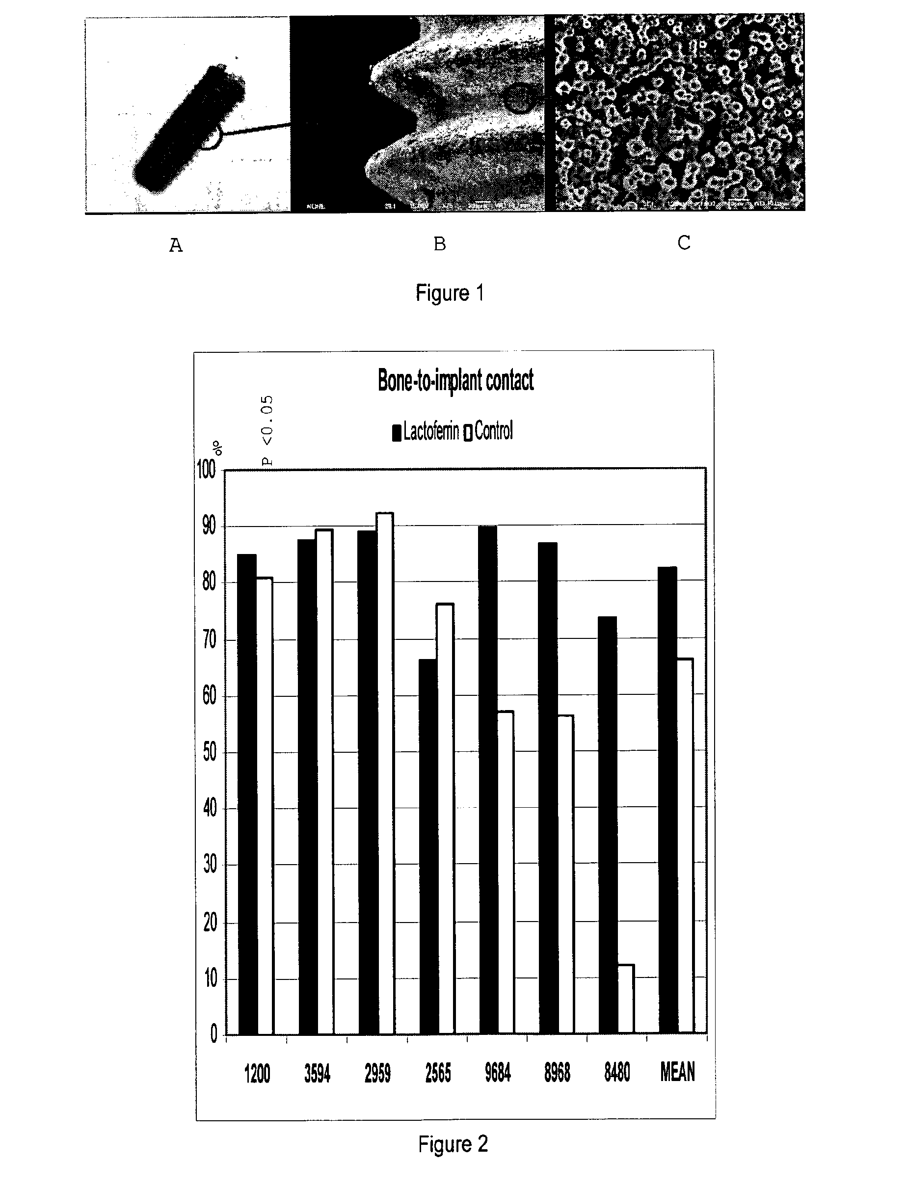 Bone implant application