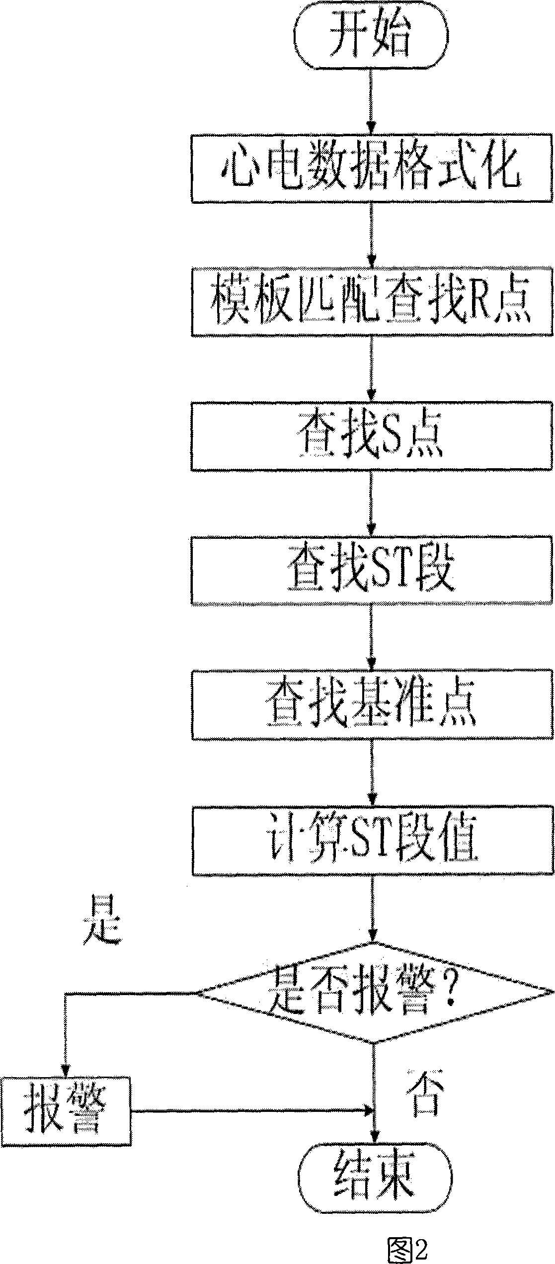 Automatic recognition of EC G ST section based on template match