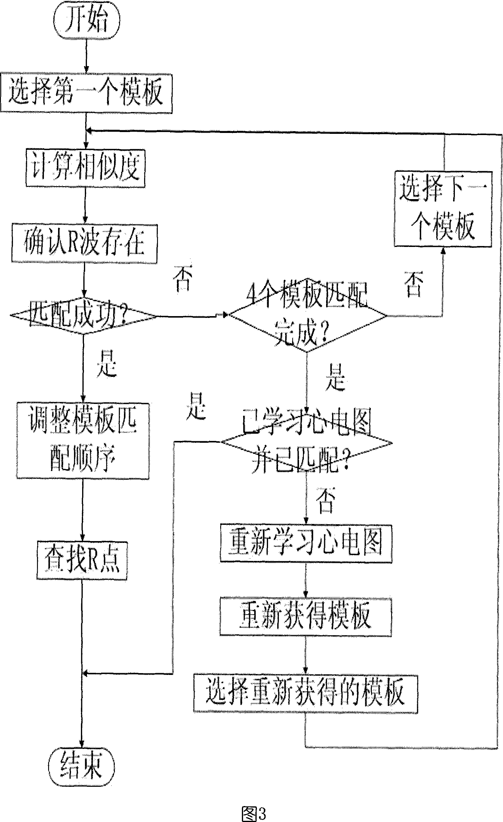 Automatic recognition of EC G ST section based on template match