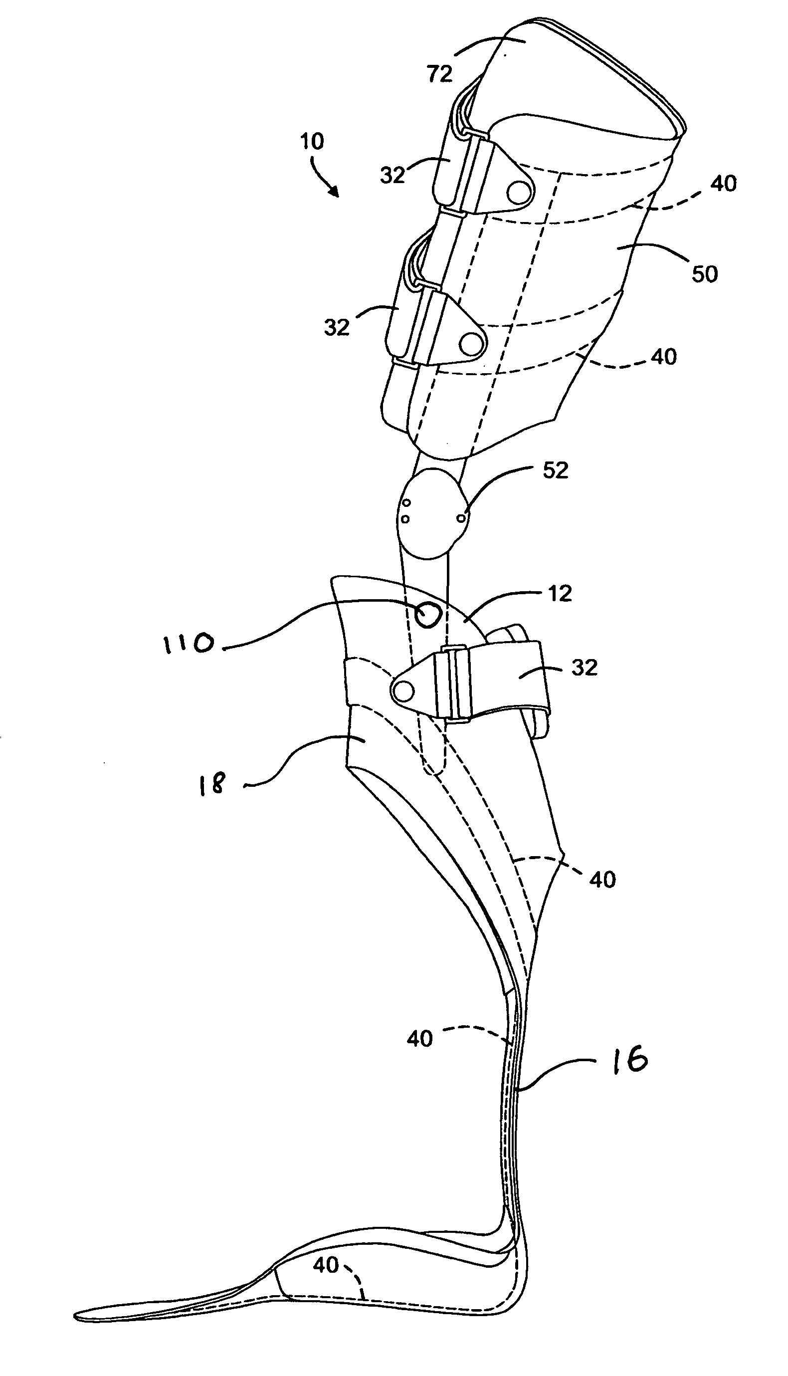 Carbon fiber orthosis and associated method