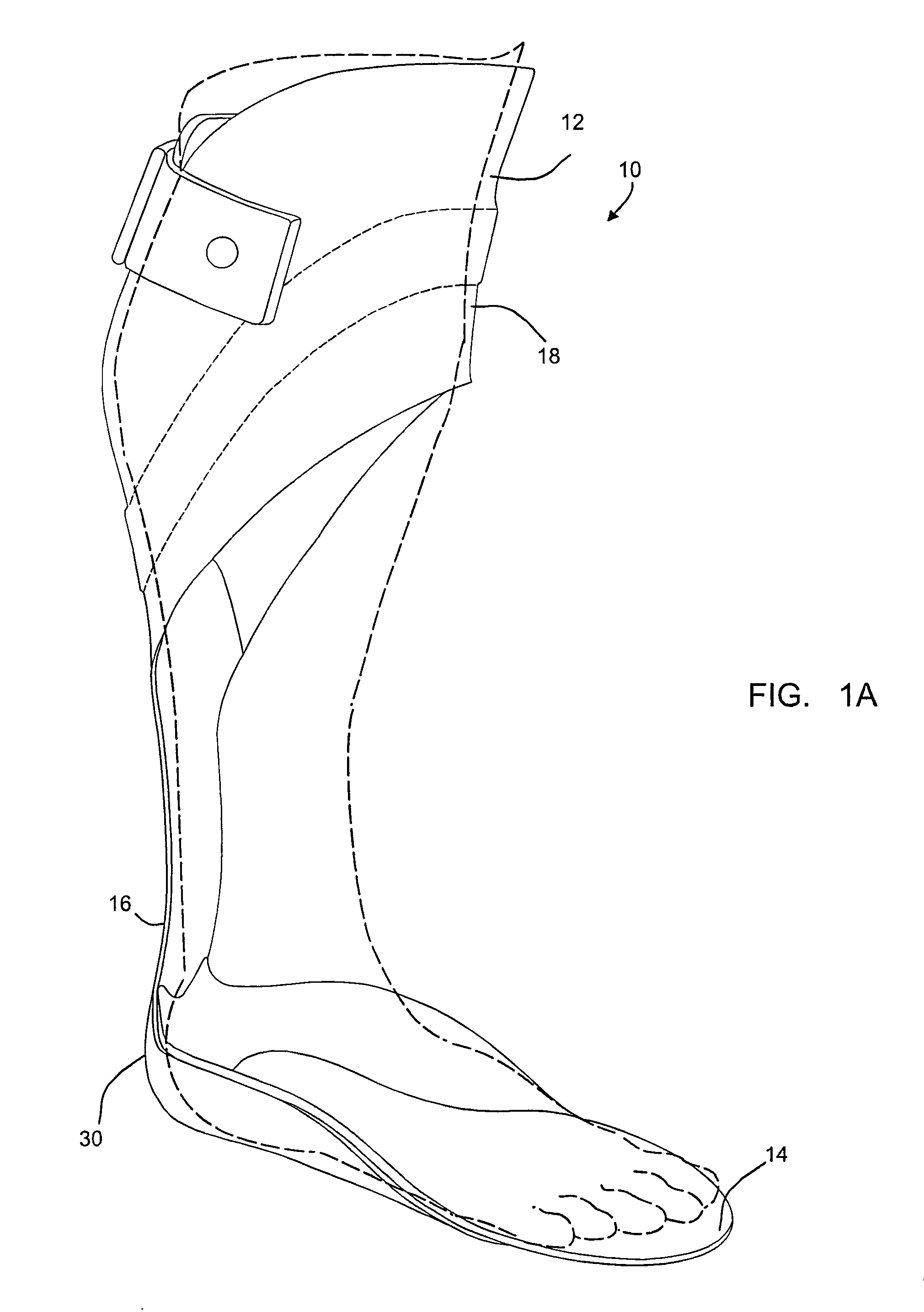 Carbon fiber orthosis and associated method