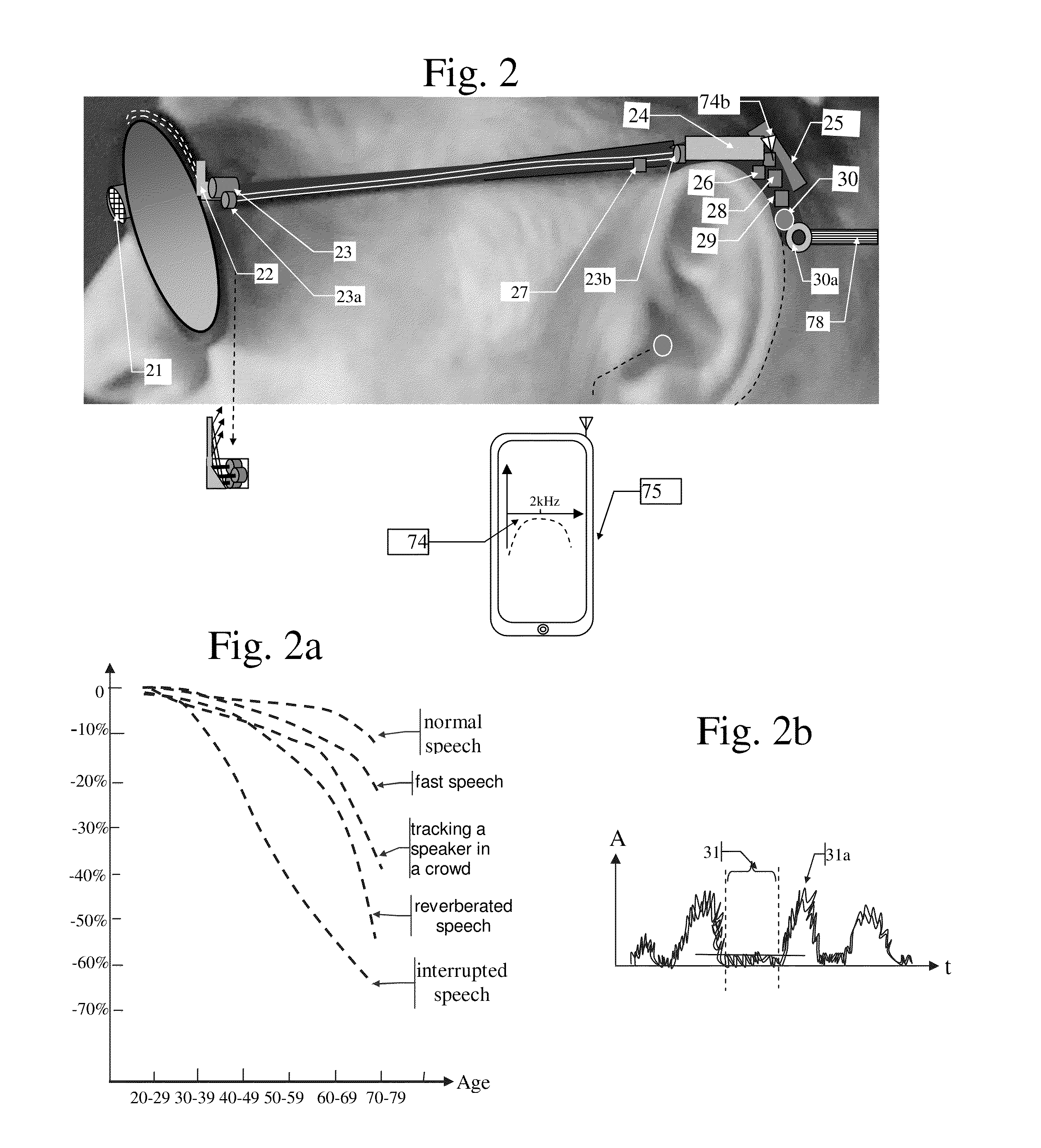 Hearing devices based on the plasticity of the brain