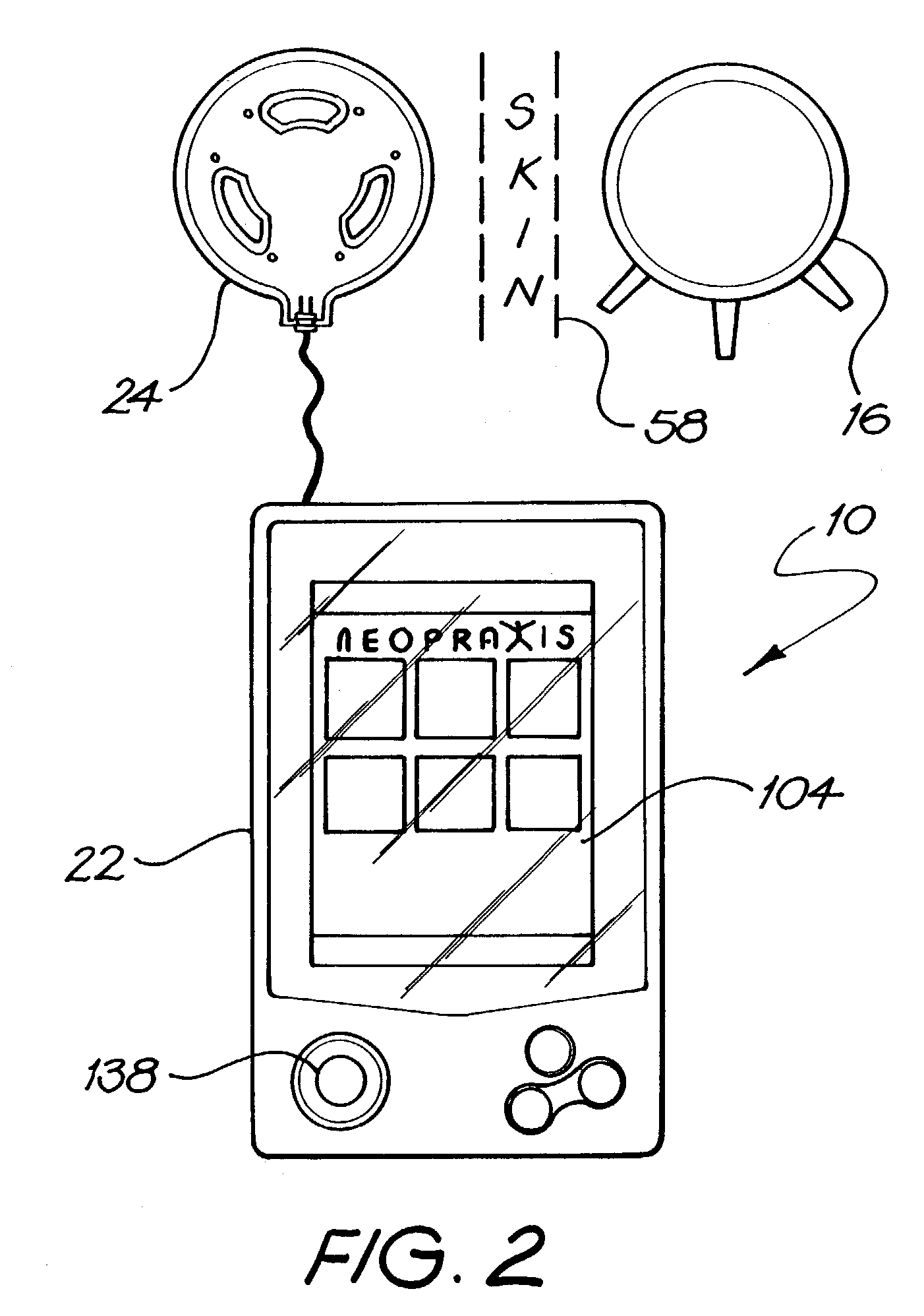 FES stimulator having multiple bundled leads